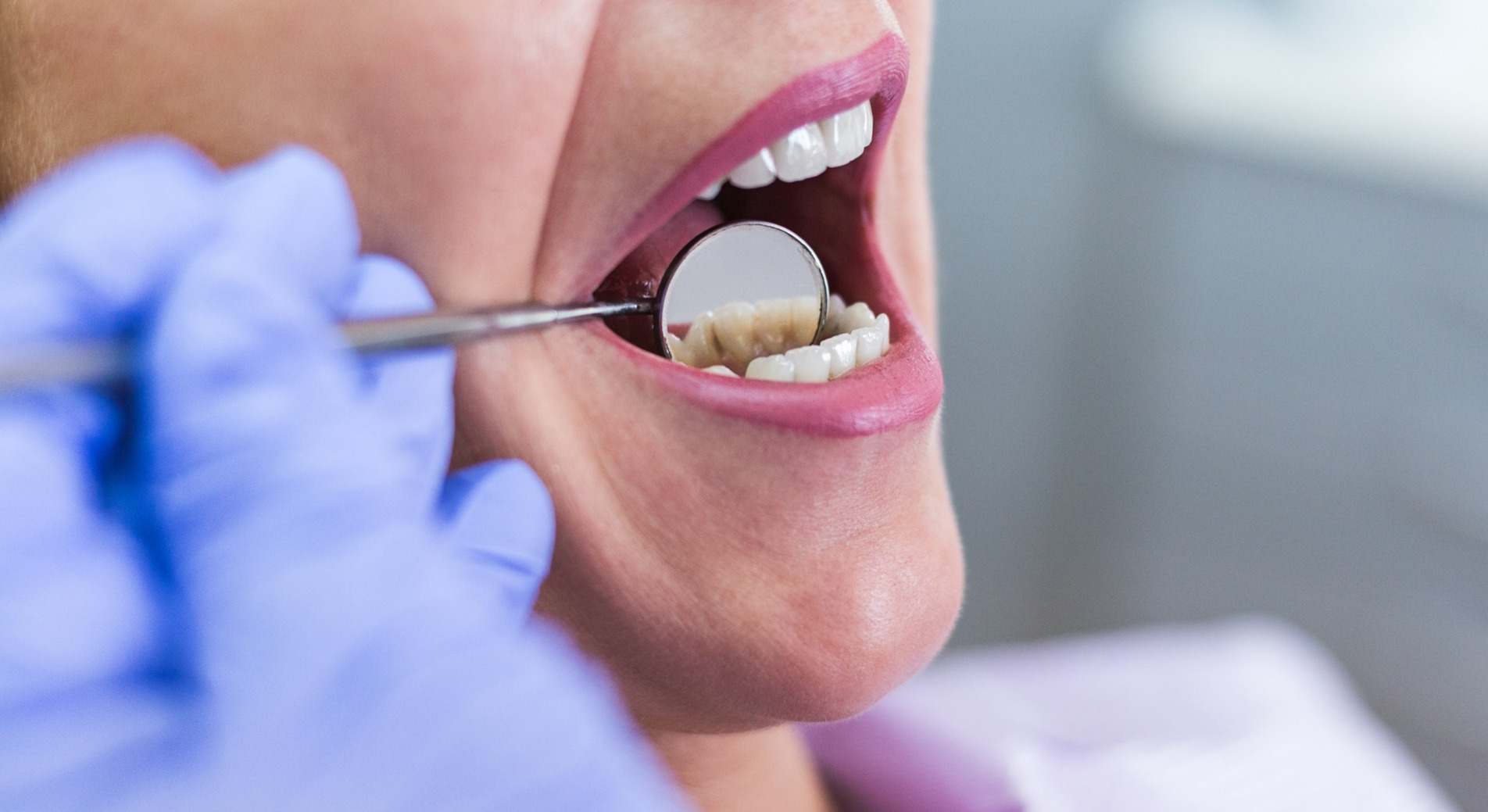 Mujer en el dentista durante un examen
