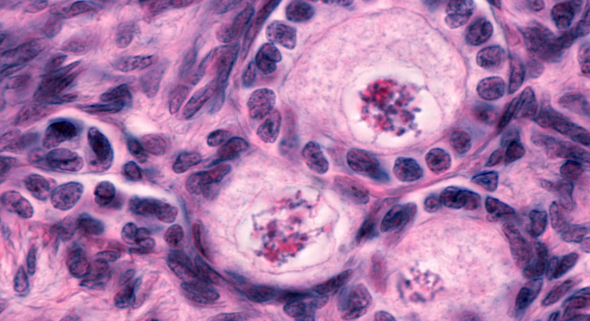 Encuentran microplásticos en el líquido folicular.