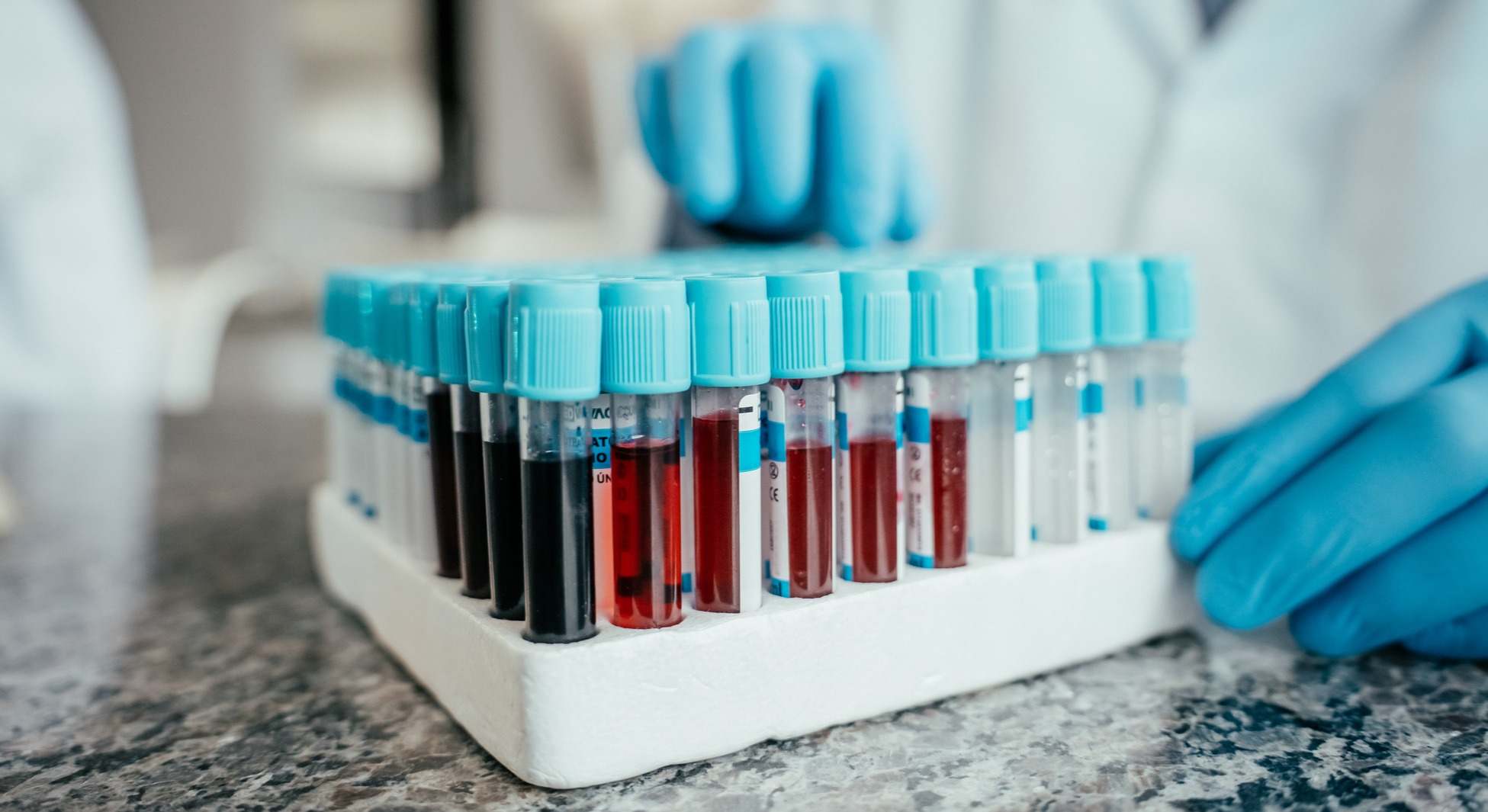 Varias muestras de sangre