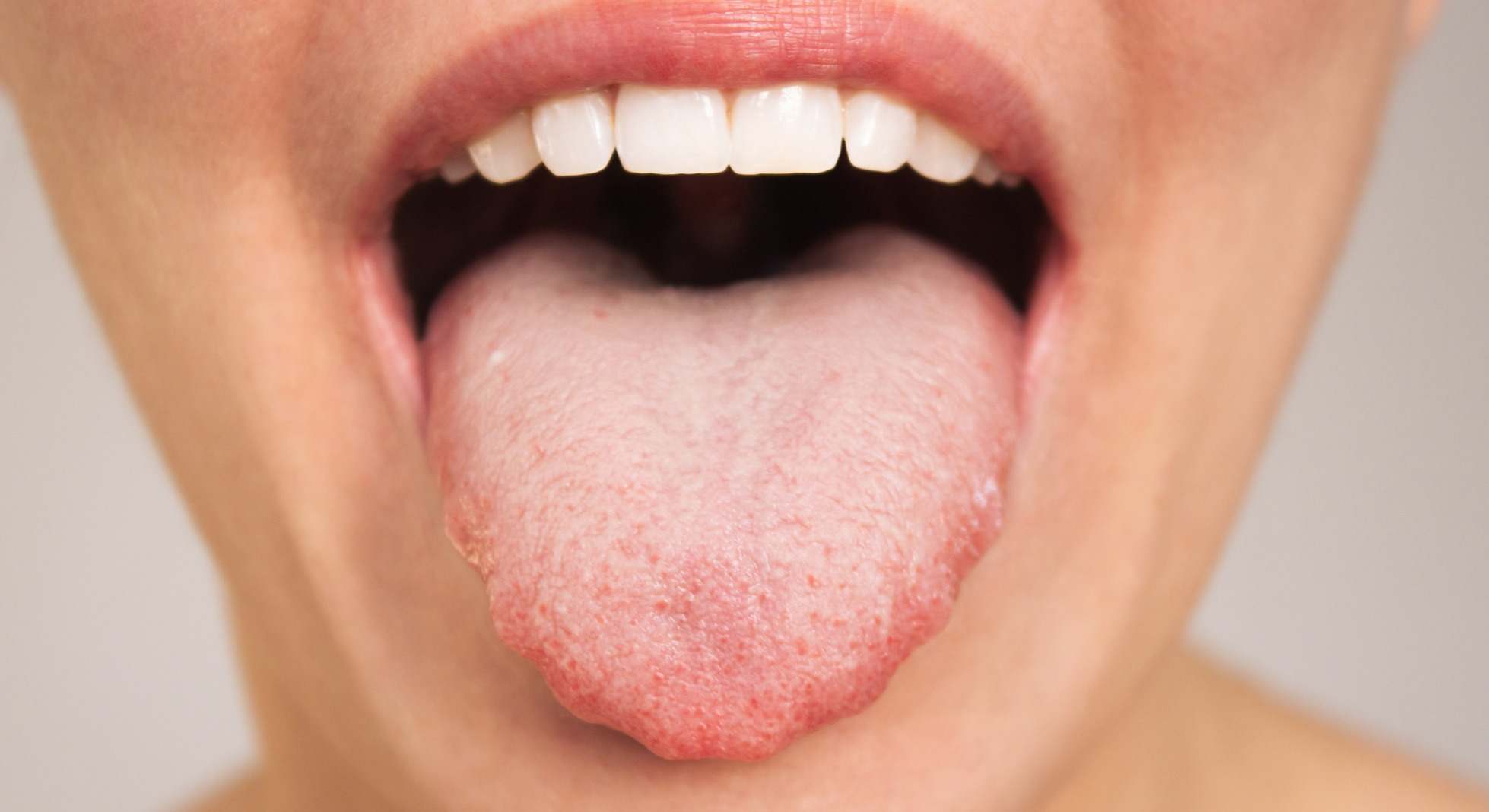 Mujer con la boca abierta mostrando la lengua y los dientes