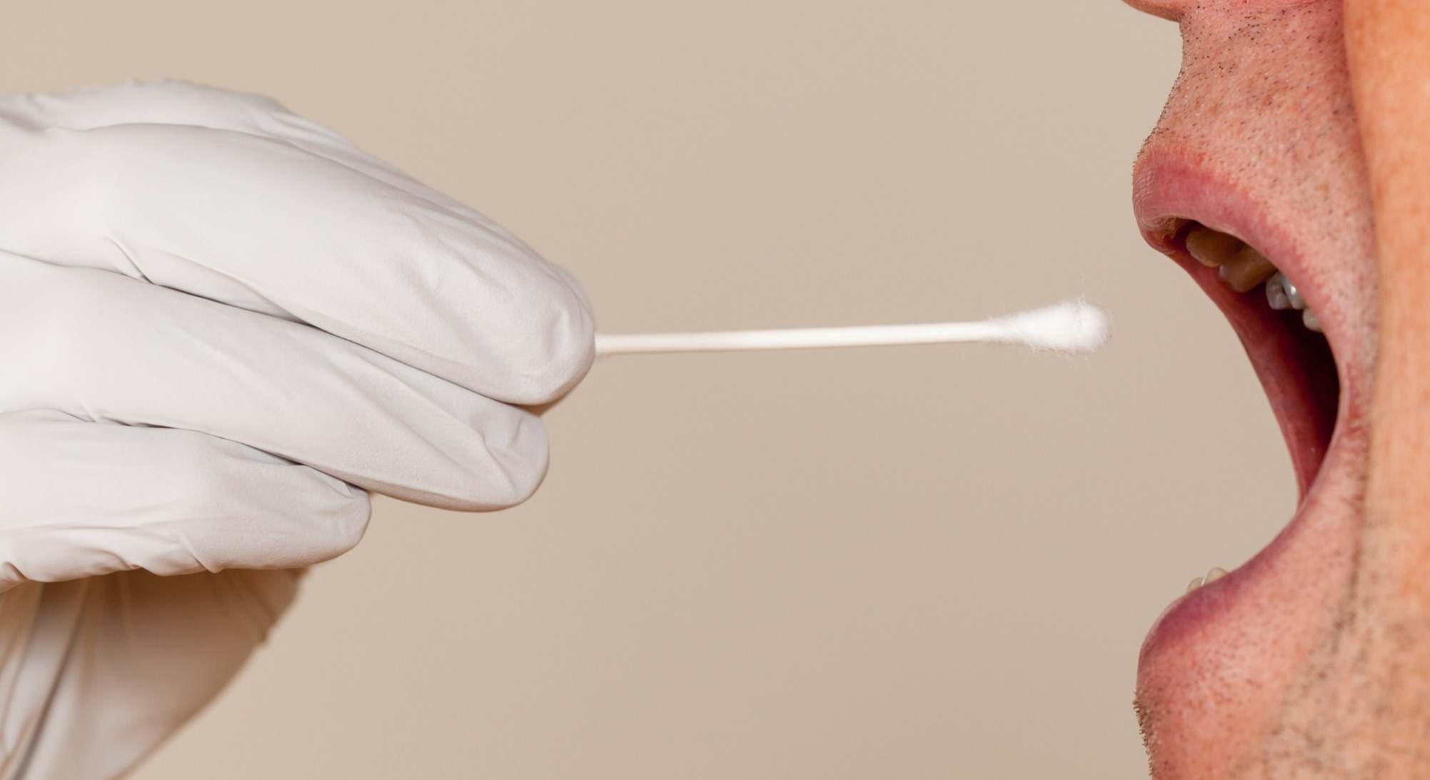 Muestra de saliva tomada a un hombre