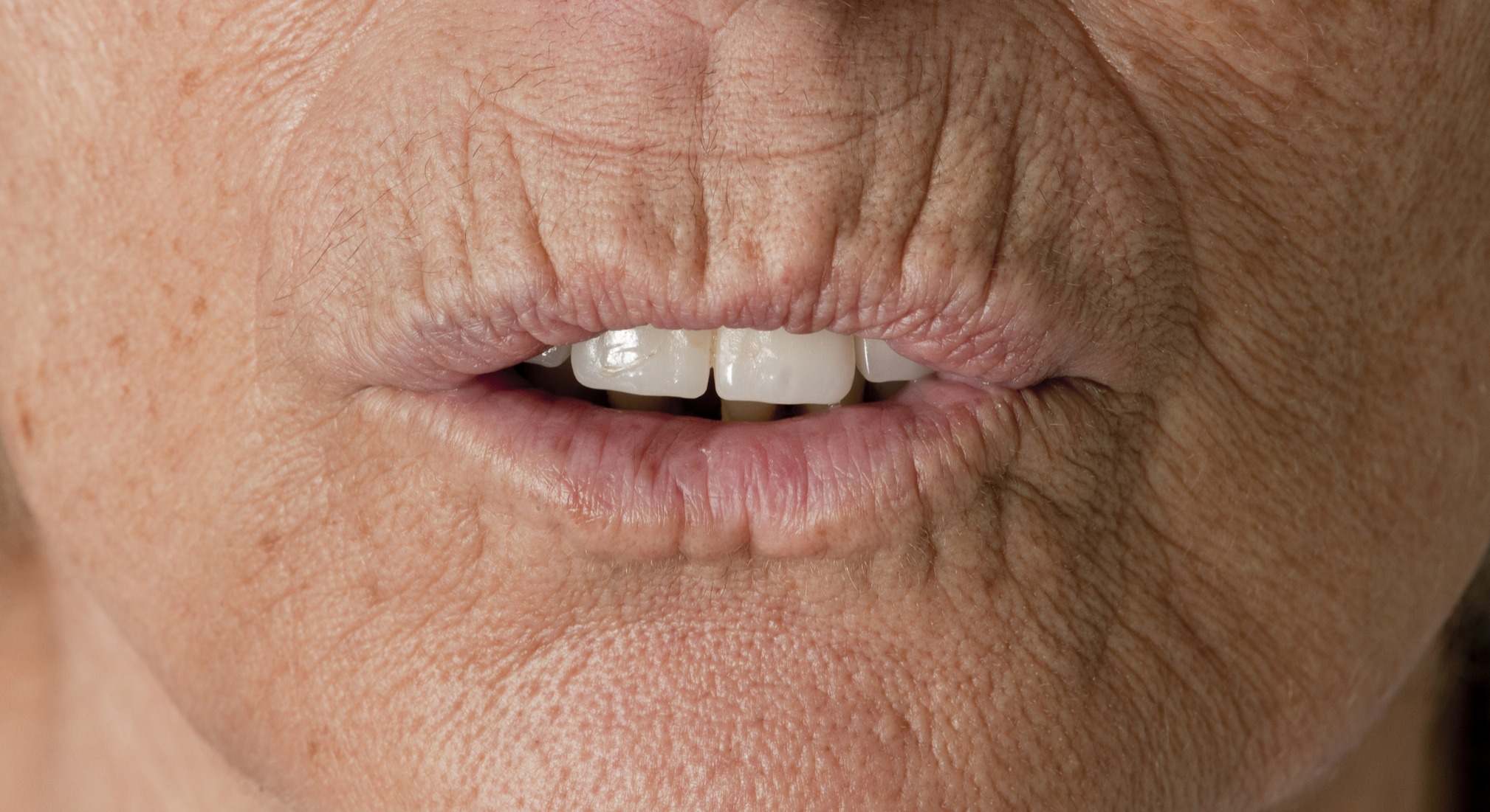 El hábito que está haciendo que se disparen los casos de "labios de fumador".