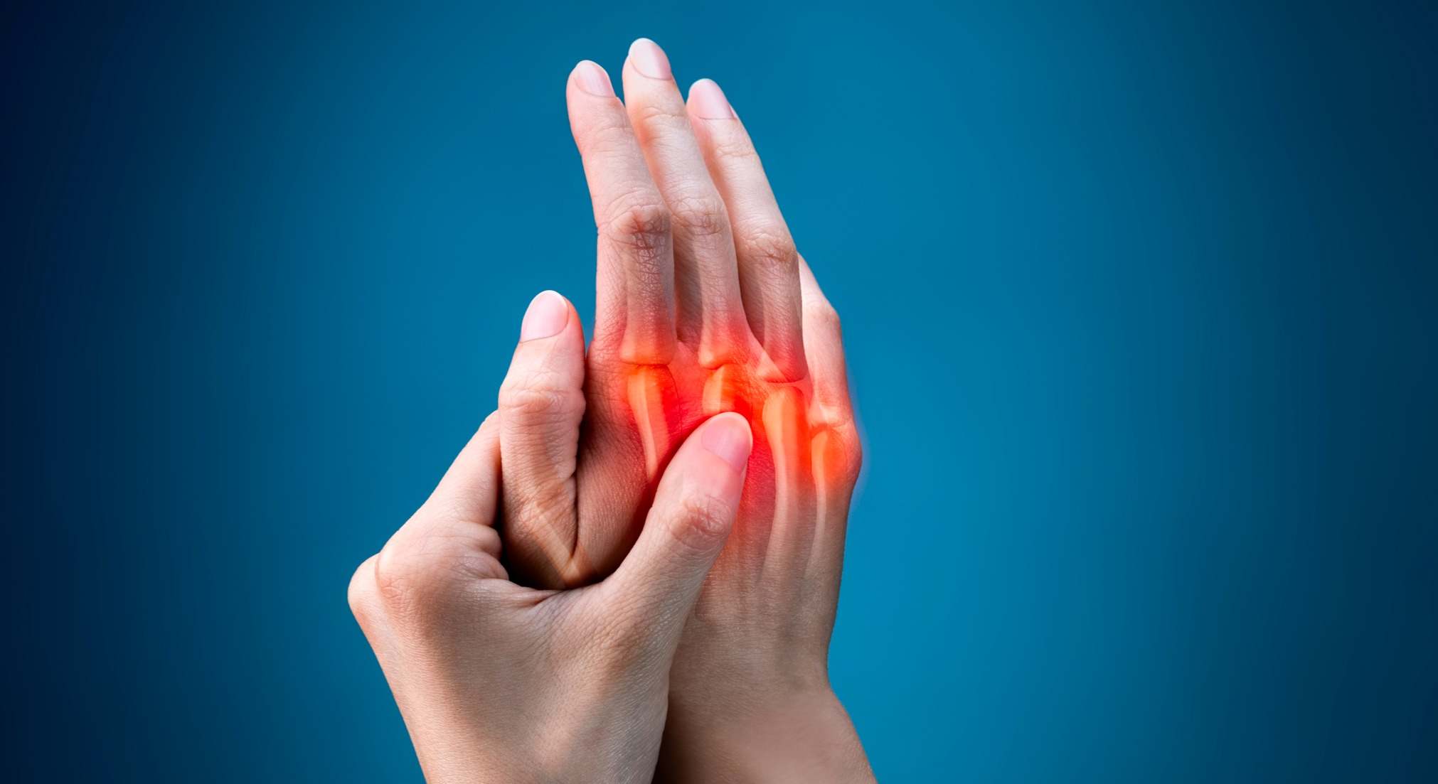 Artritis reumatoide