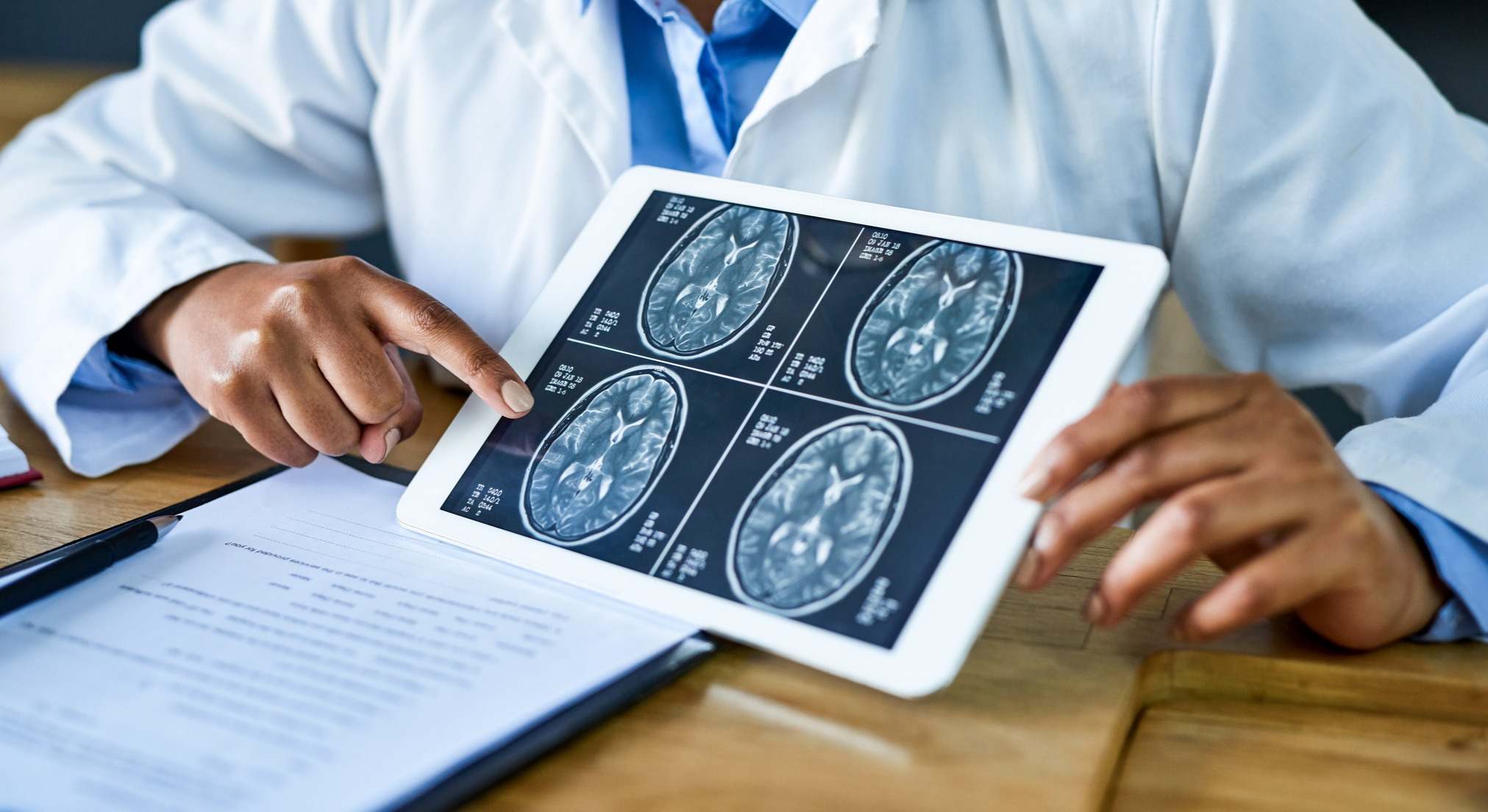 Médico explicando el cerebro