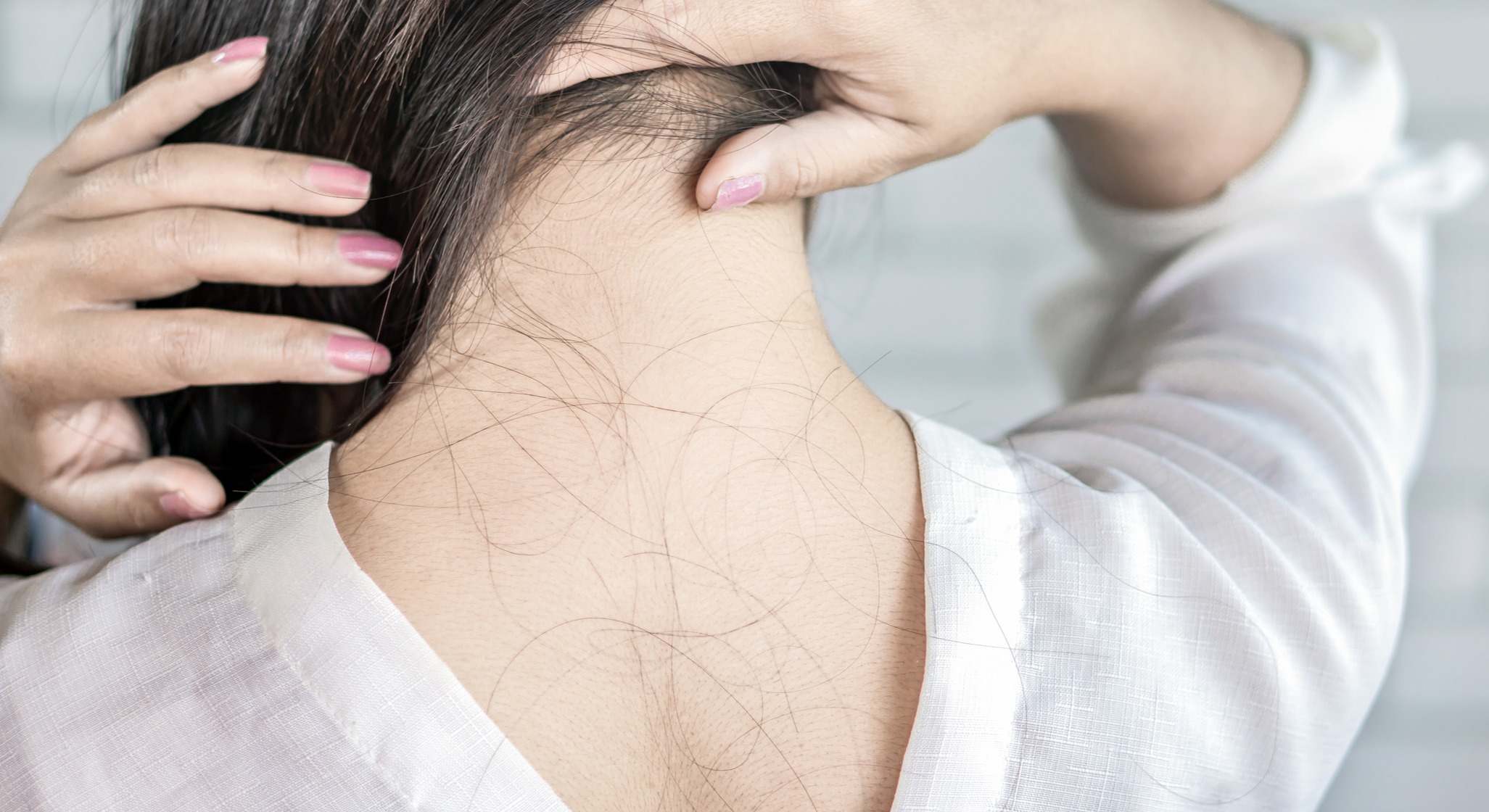 Mujer con caída de cabello en la espalda