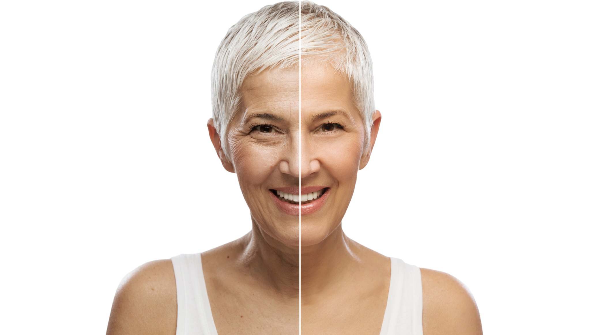 Mujer anciana con una mitad de la cara más rejuvenecida que la otra