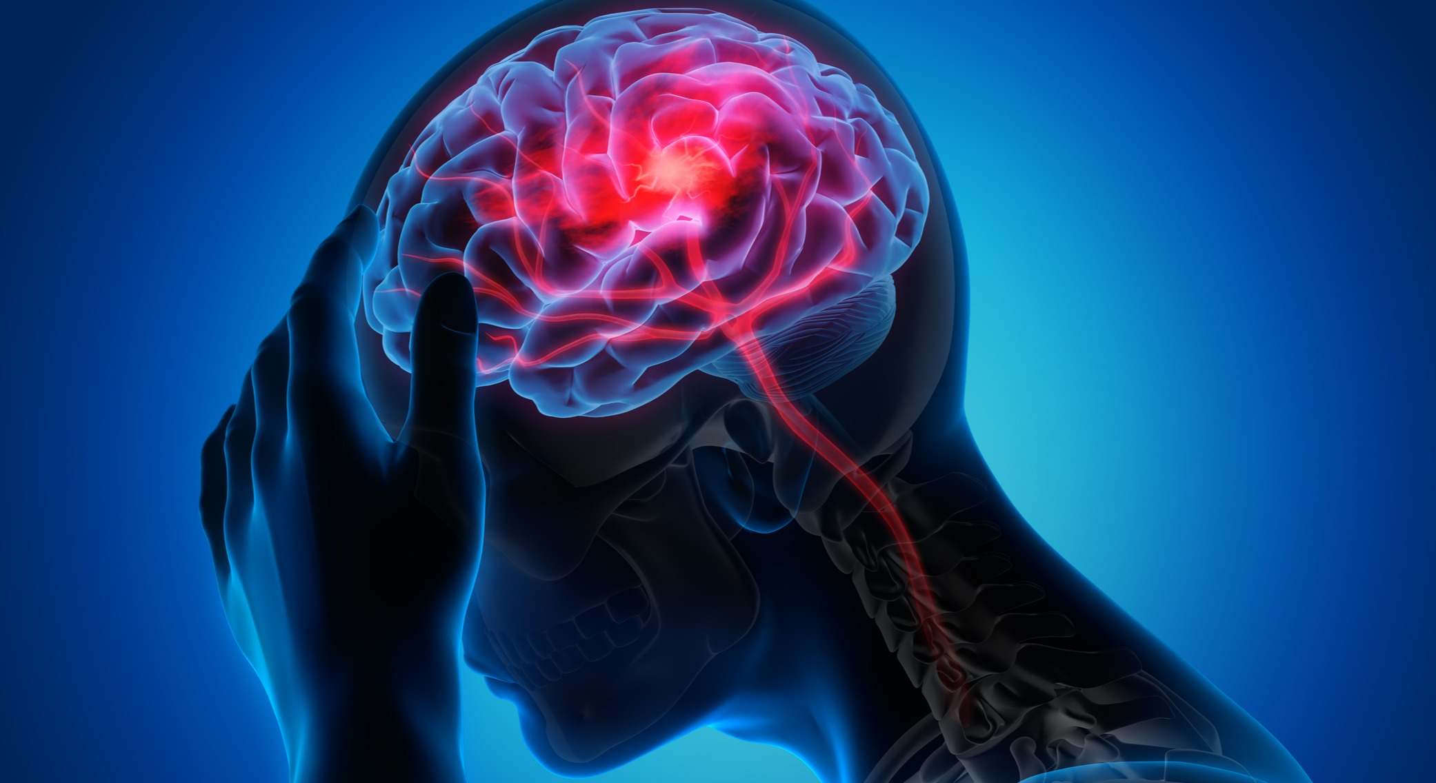 Infografía de persona con dolor de cabeza