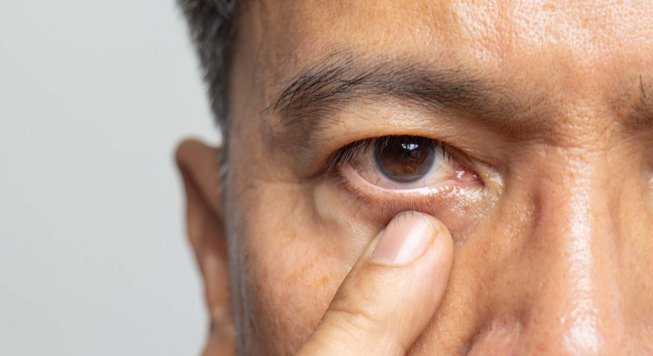 Hombre señalando su ojo con un dedo