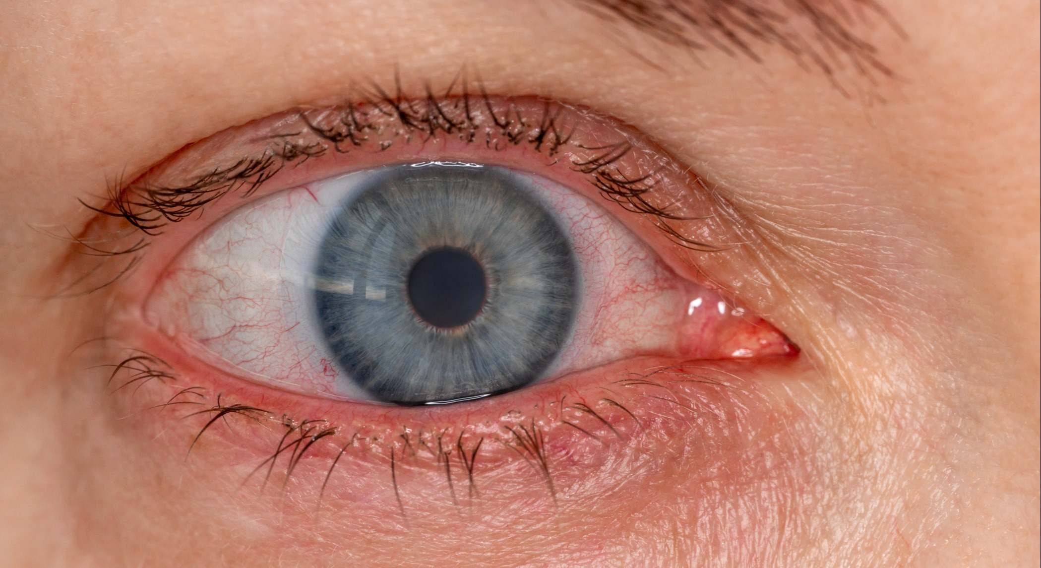 Retina | Firma: iStock