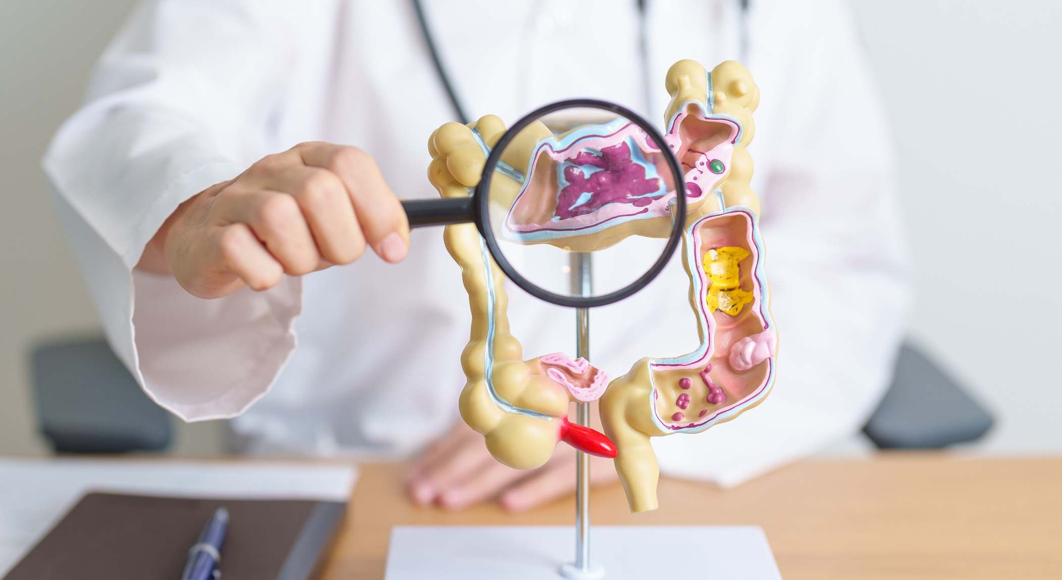 Doctor con modelo de anatomía de colon humano y lupa