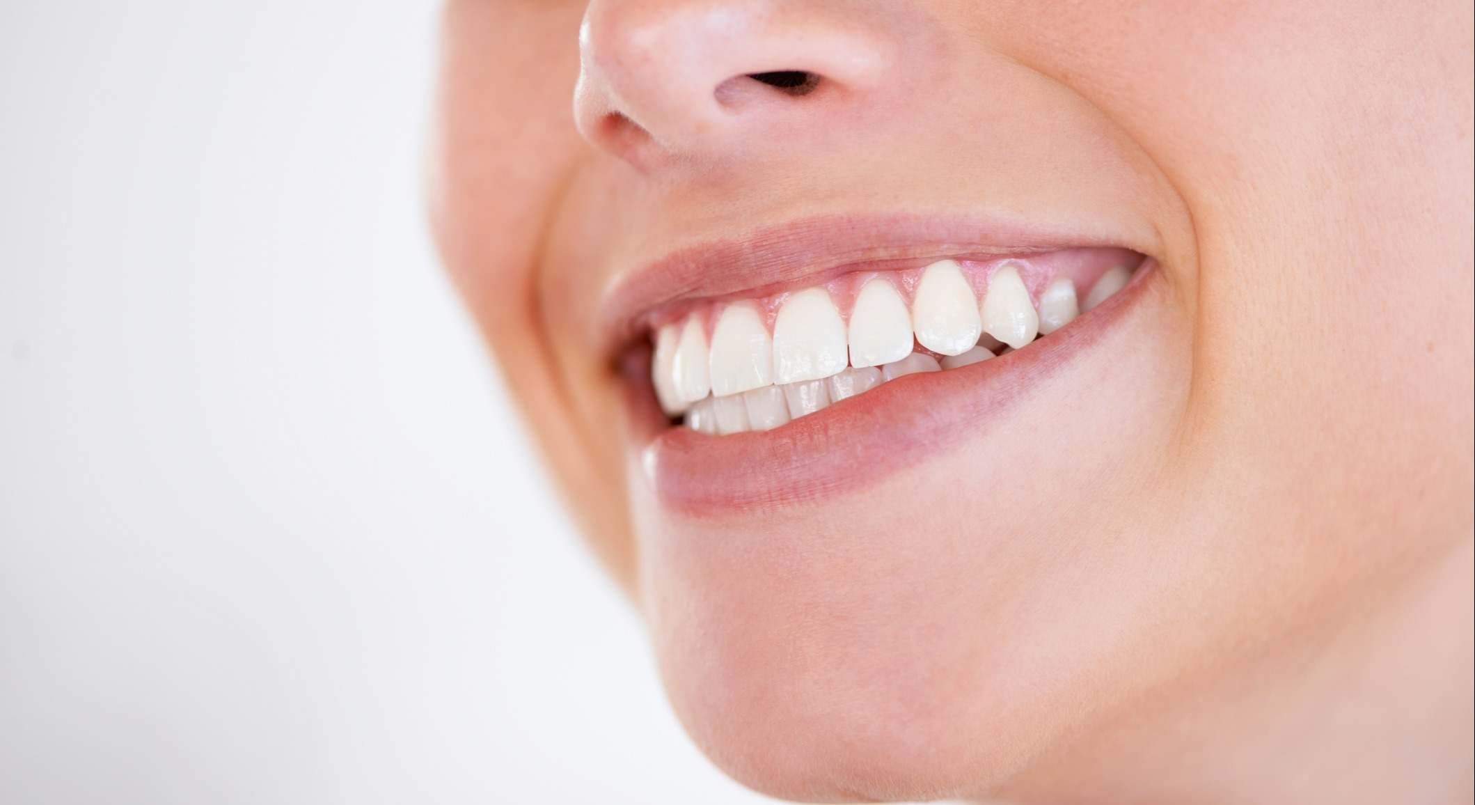 Una mujer sonríe con los dientes blancos. / Foto: iStock