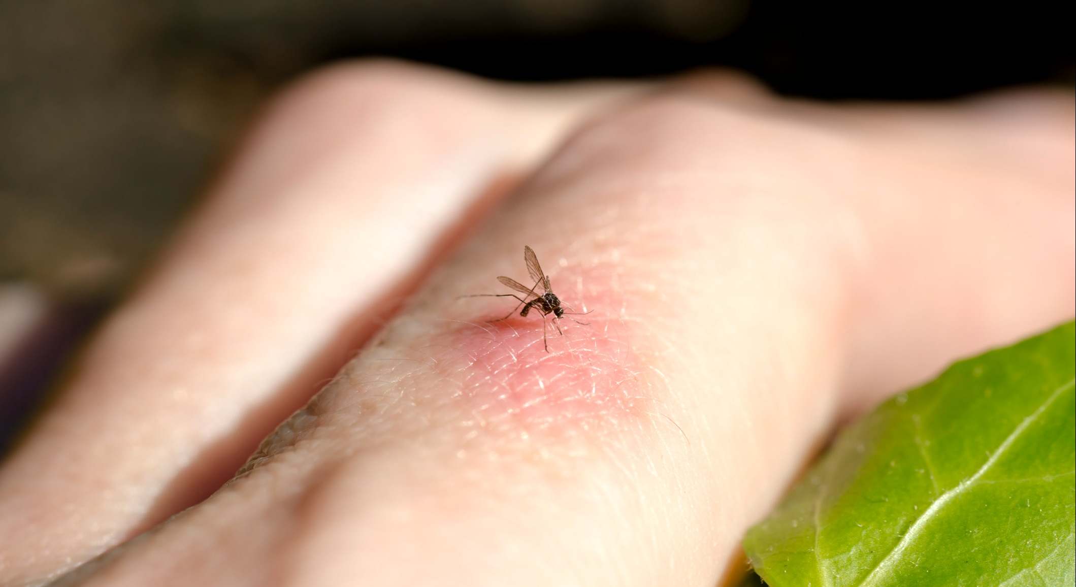 Picadura de mosquito