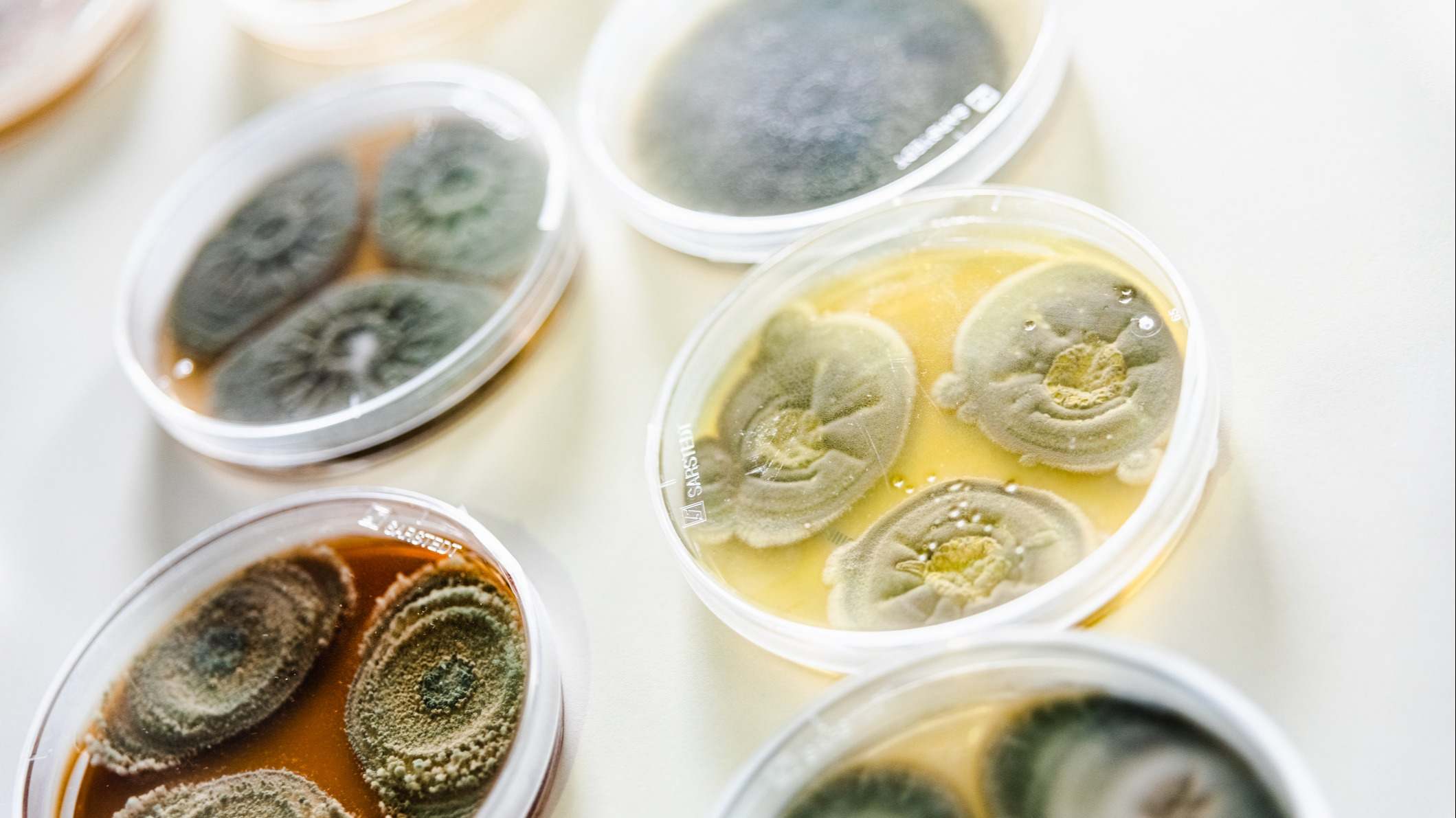 Muestras de distintos tipos de hongos y bacterias para analizar agua y alimentos contaminados en un laboratorio