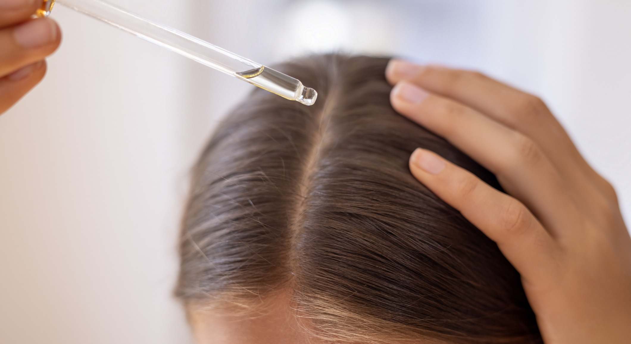 Tratamiento para la alopecia, contra la caída del cabello. / Foto: iStock