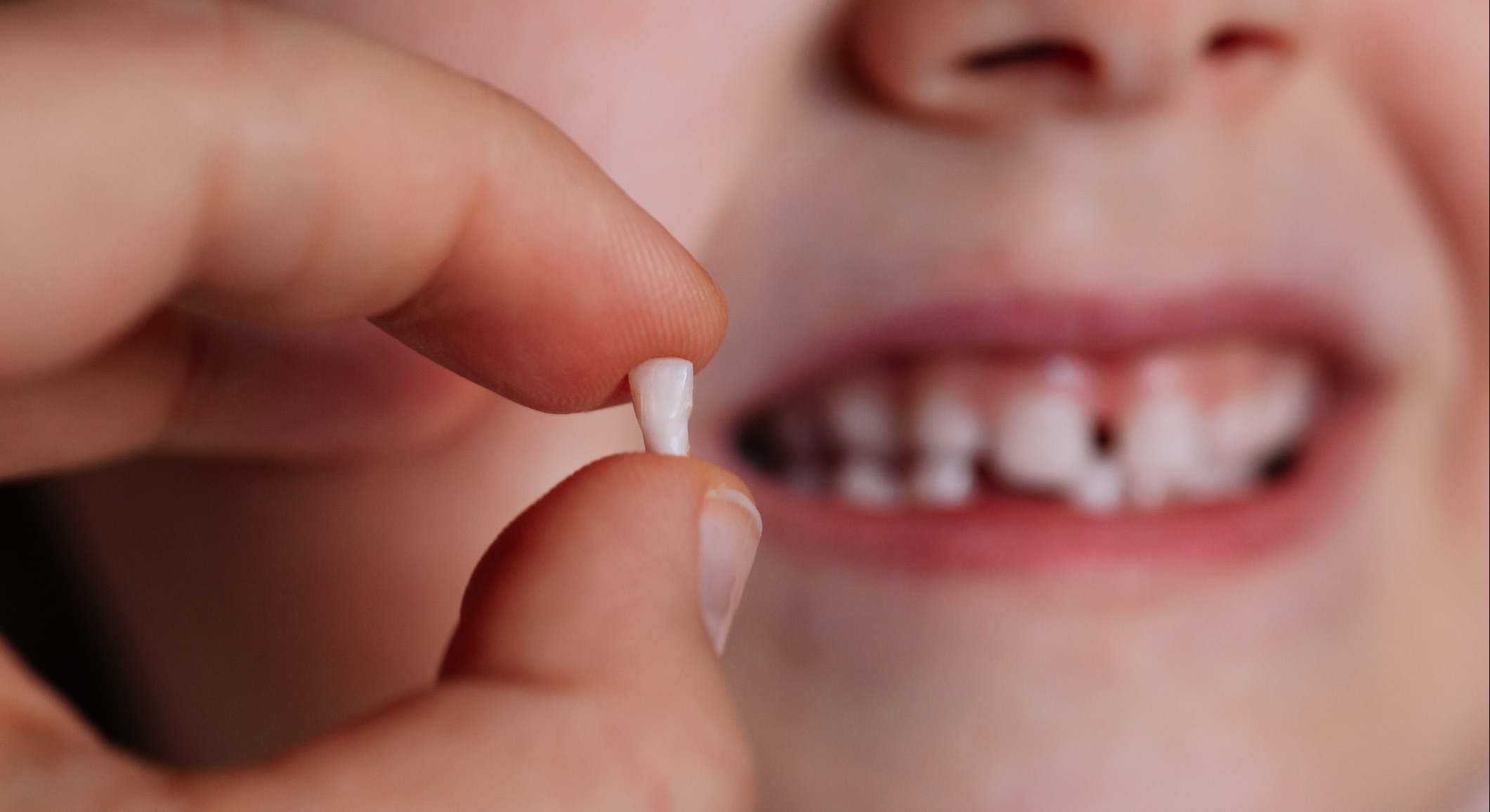 Banco de dientes de leche potencialmente engañosos: las células madre dentales todavía no curan el autismo y la diabetes
