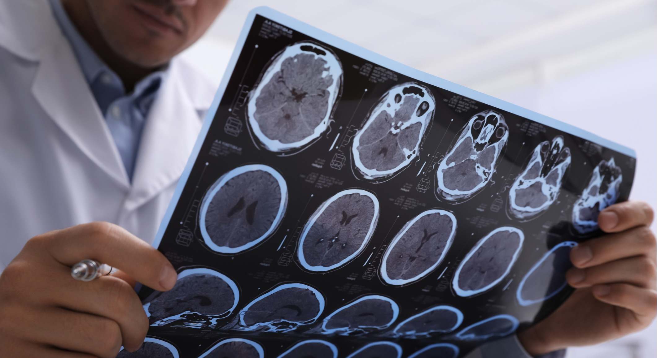 Médico que examina imágenes de resonancia magnética