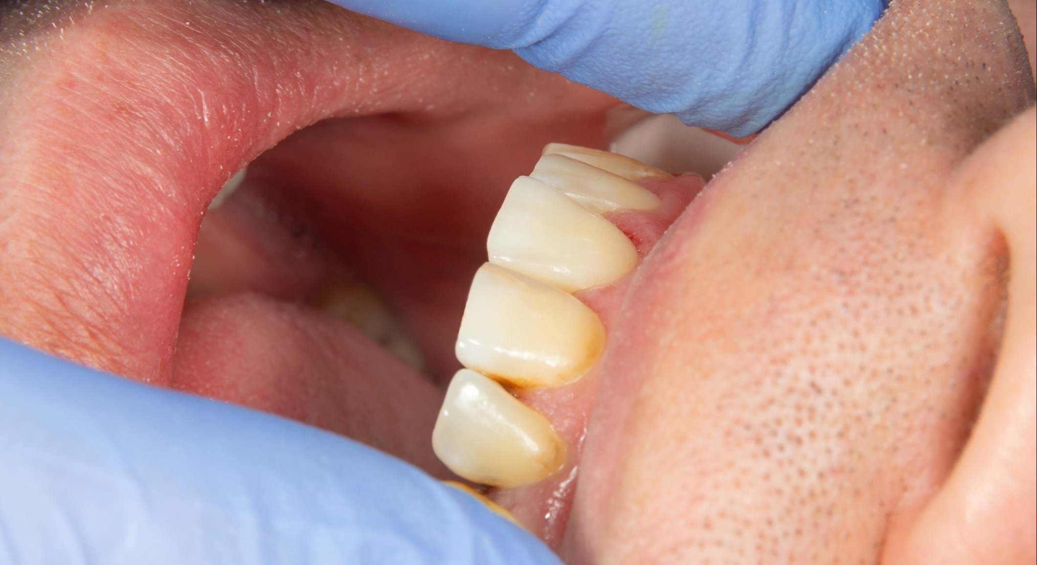 Dientes de un paciente de un dentista