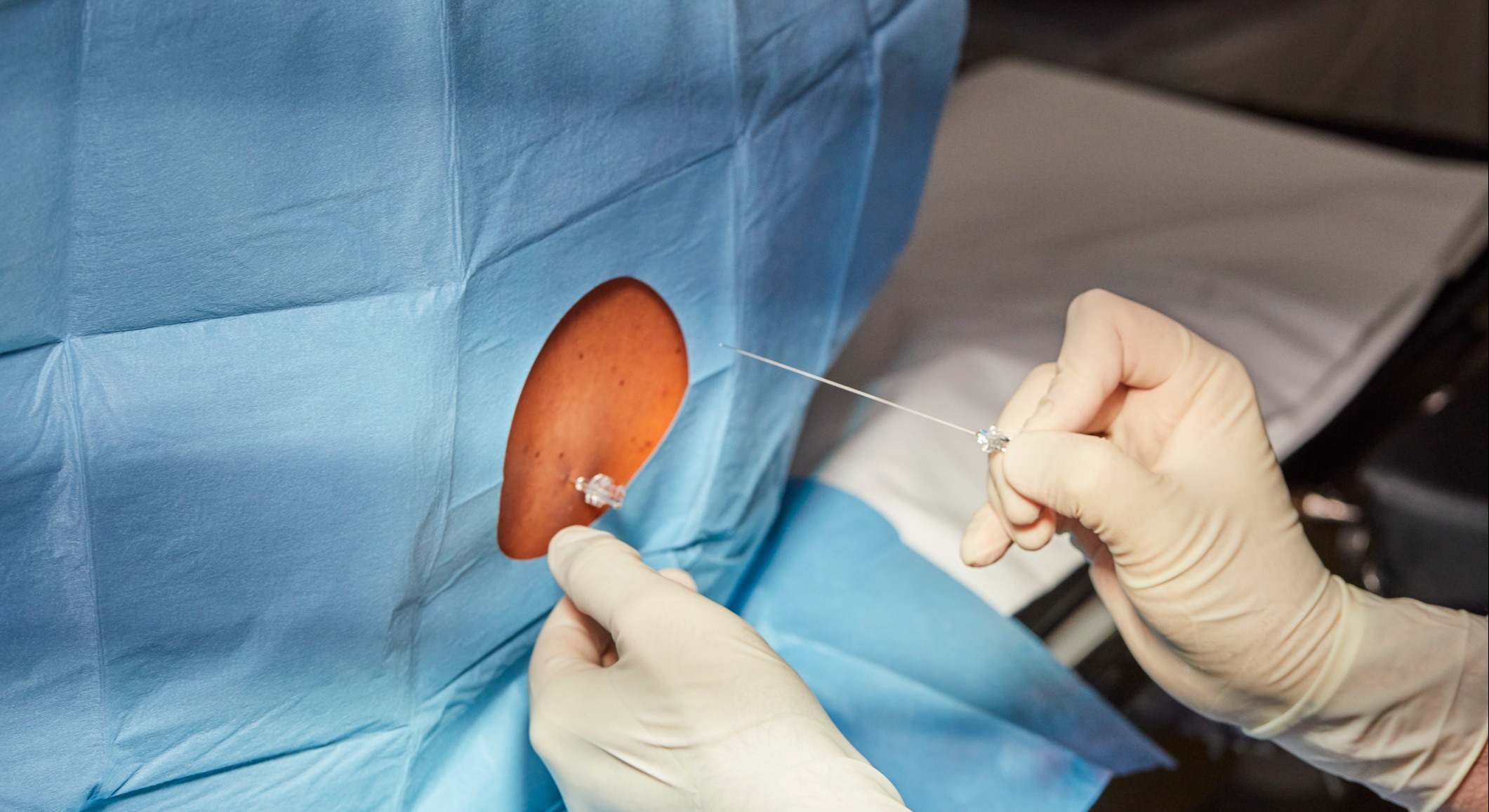 Epidural