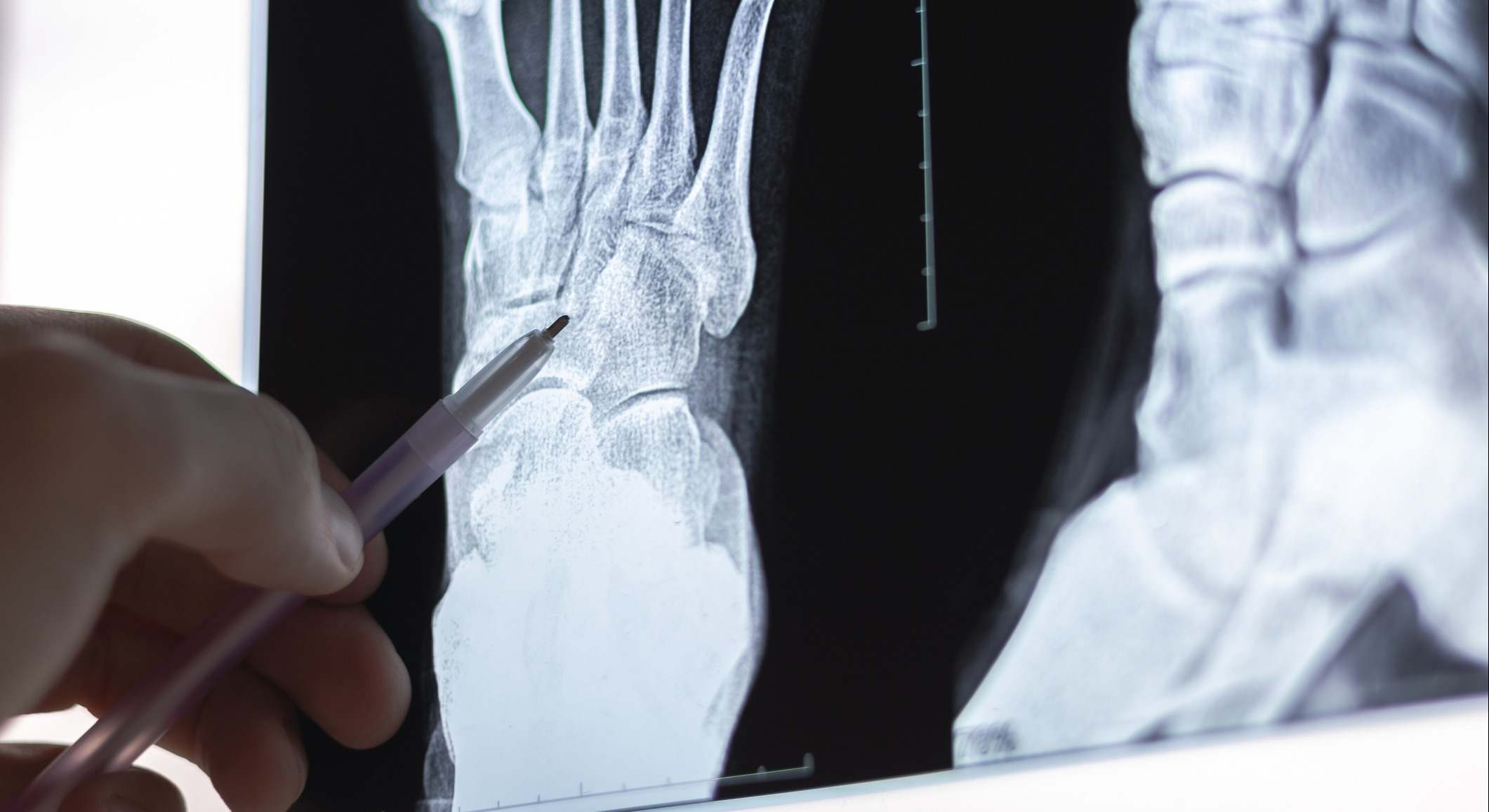 Un médico examinando una radiografía