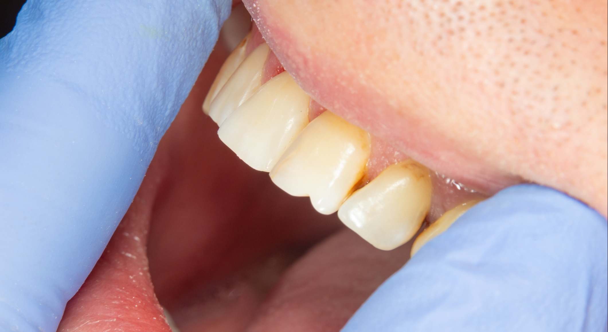 Dientes del paciente de un dentista