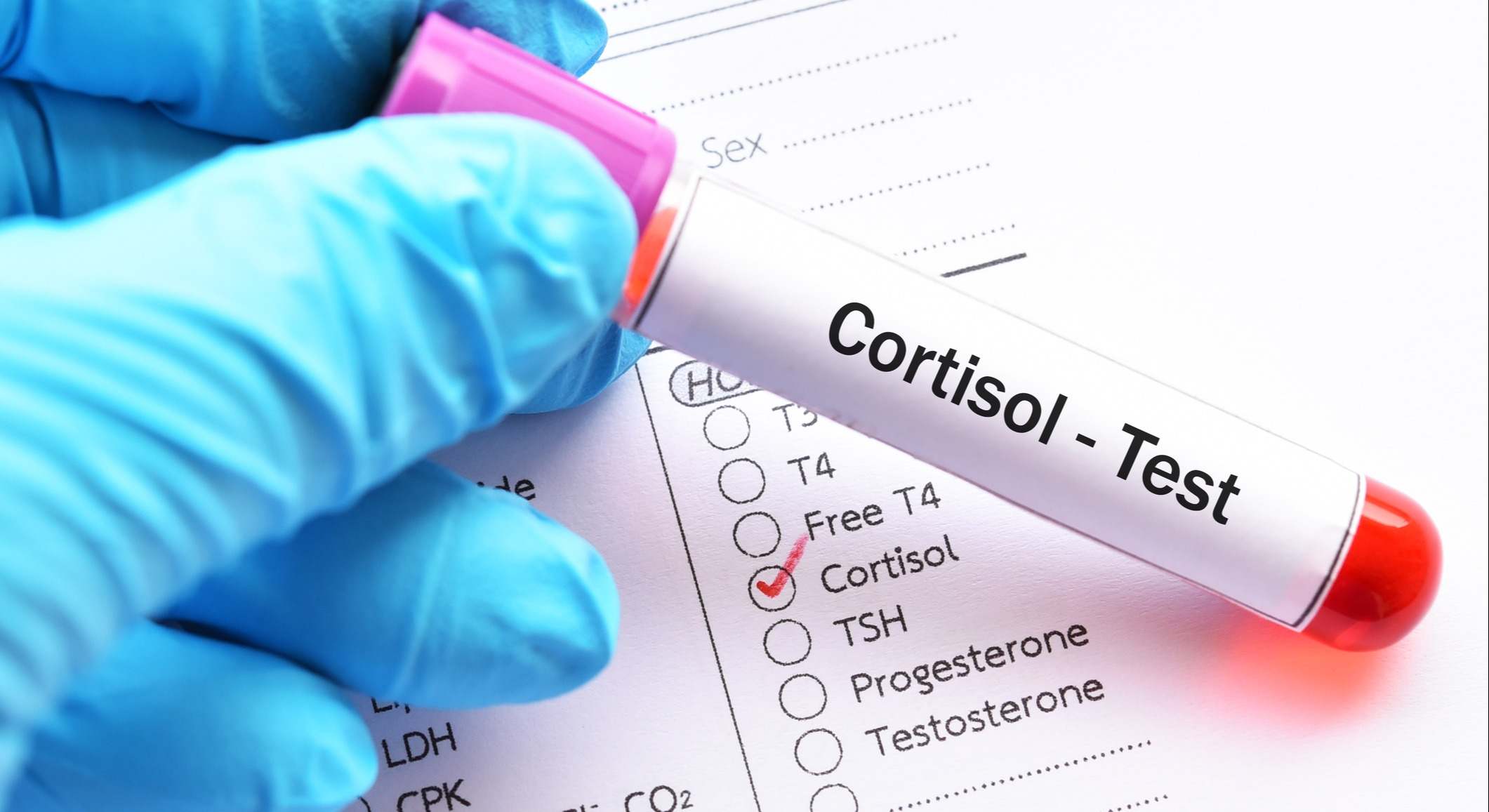 Si presentas estos síntomas podrías tener el cortisol alto.