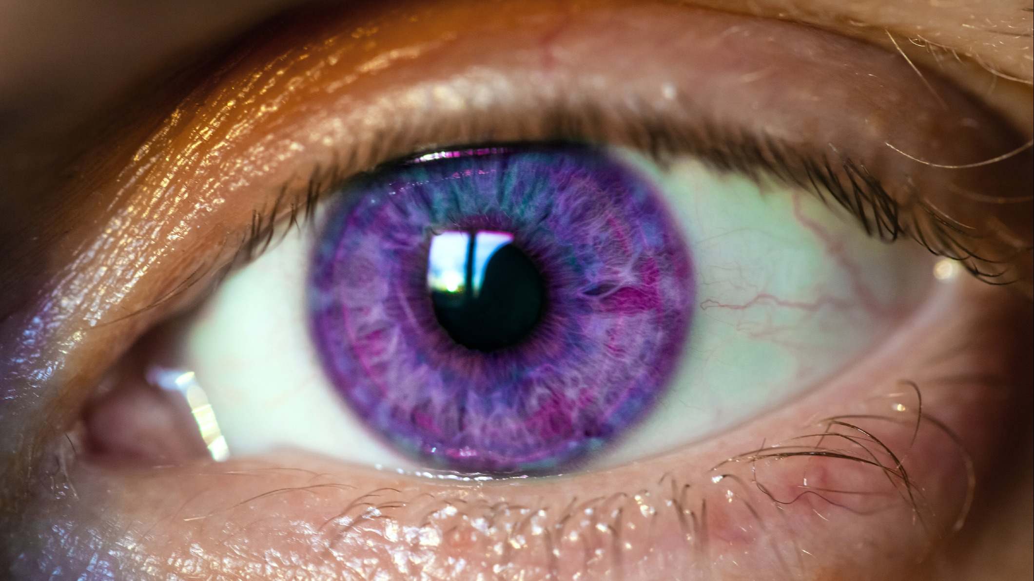 Ojo con iris púrpura