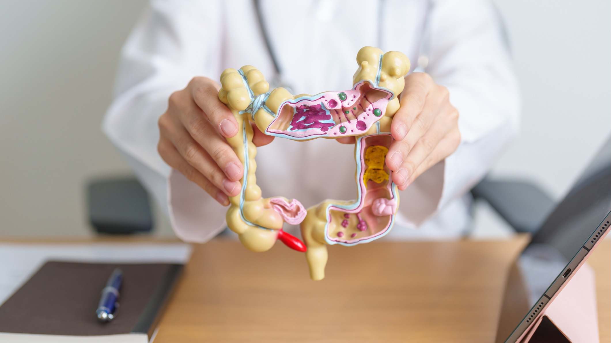 Médico con modelo de anatomía de colon humano