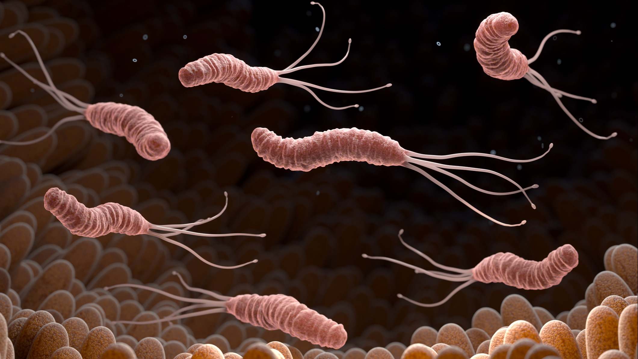 Bacteria Helicobacter Pylori en el estómago
