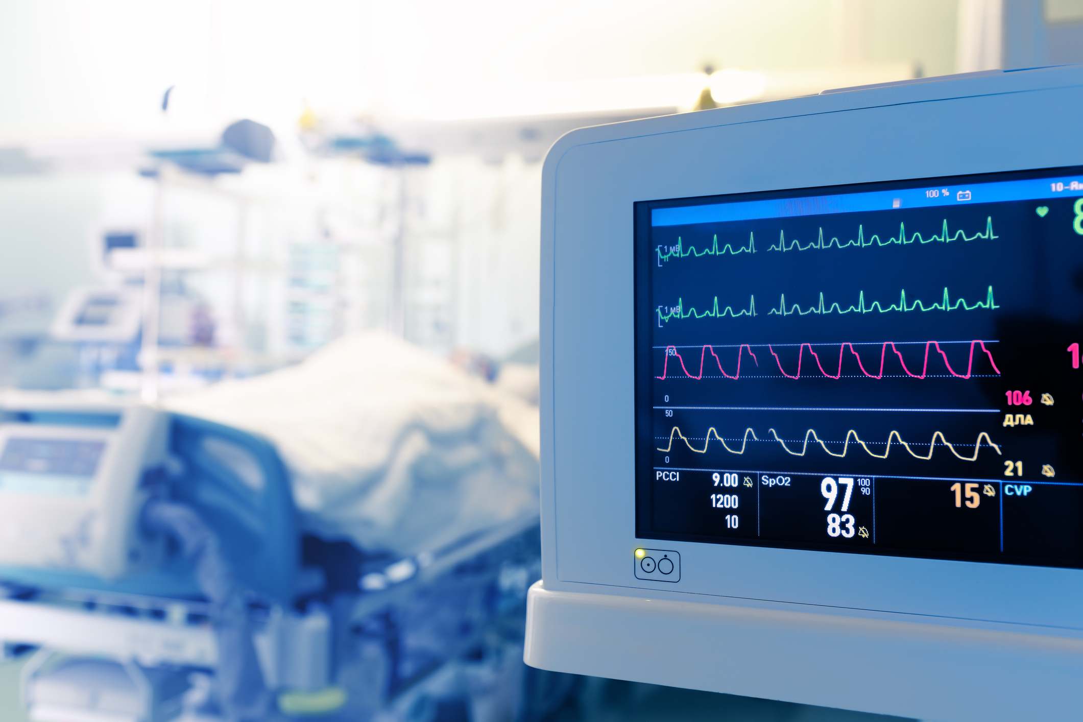 Un monitor de hospital en una habitación