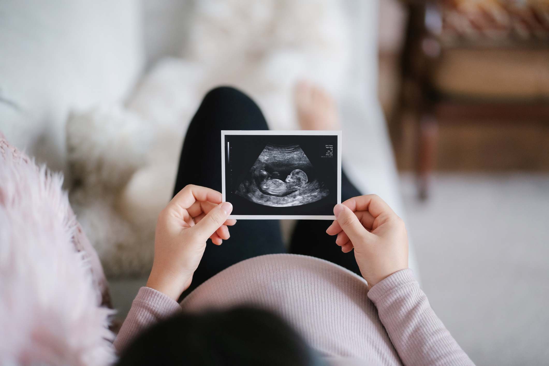 Mujer embarazada tumbada con la ecografía de su bebé