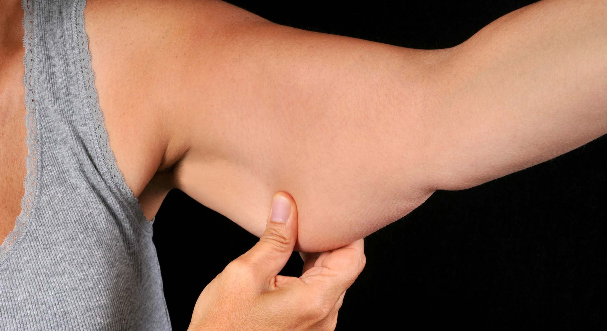 Persona con flacidez en el brazo
