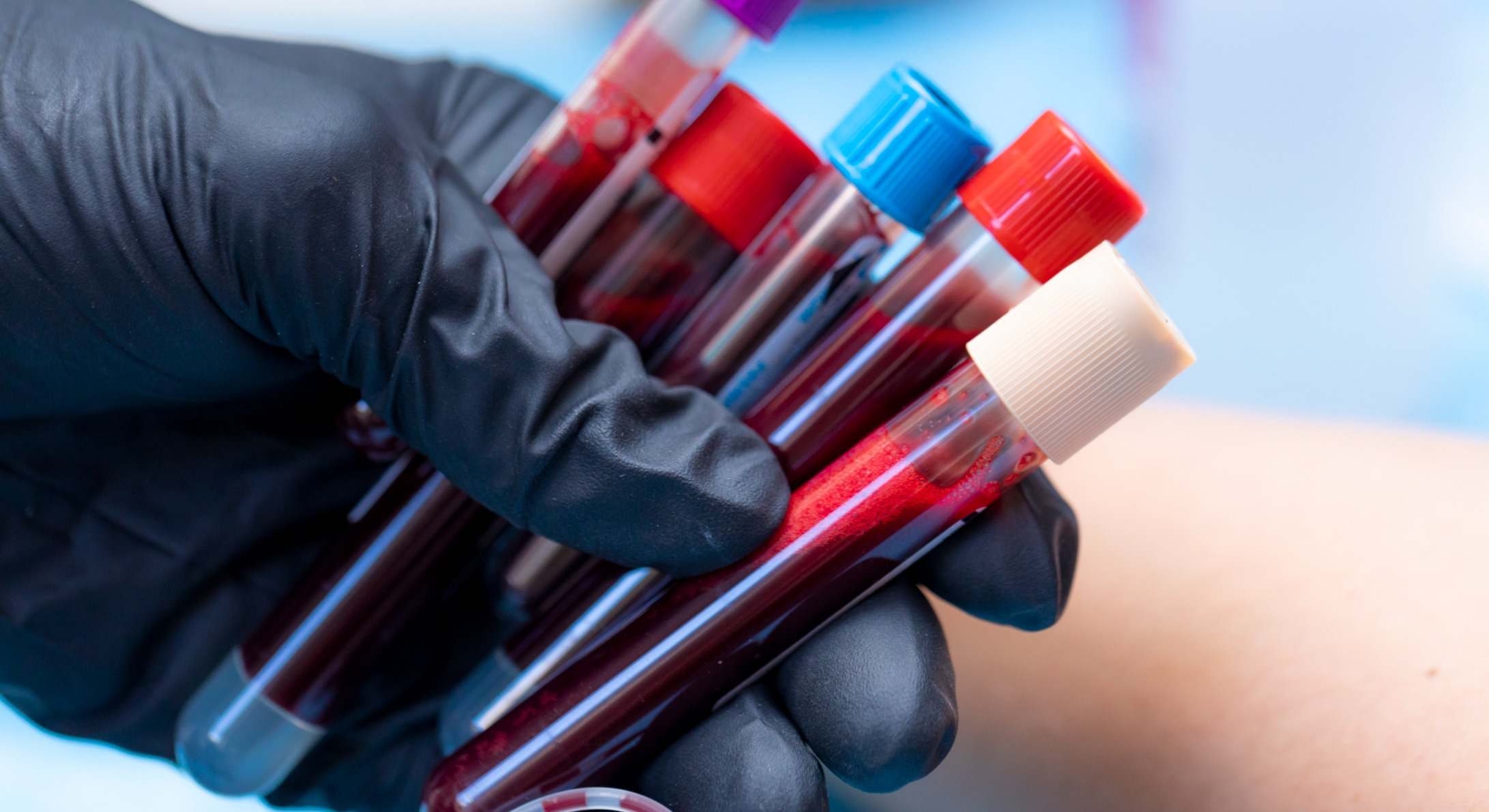 Tubos con análisis de sangre