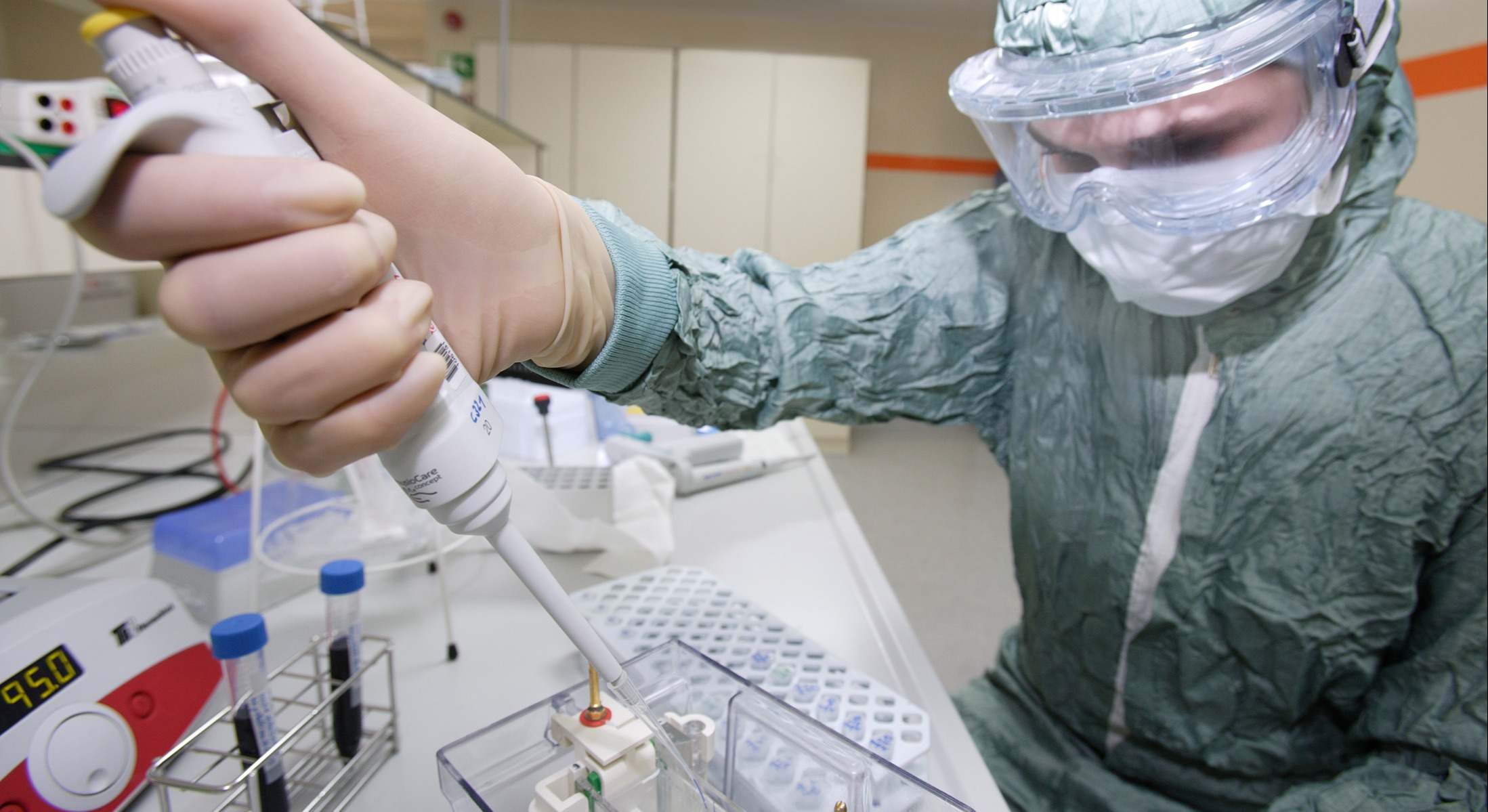 investigacionvih
