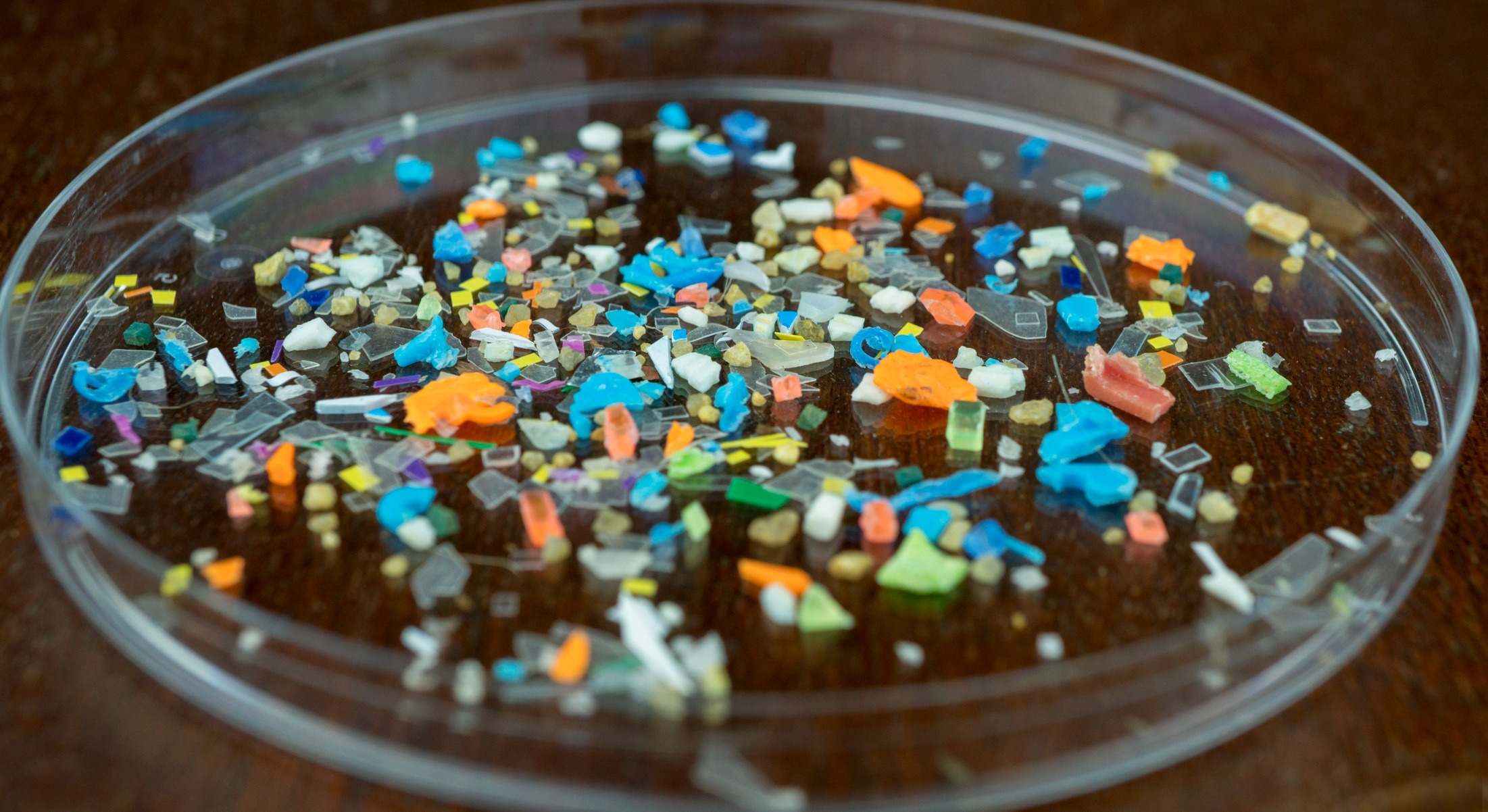 Microplásticos en el cerebro