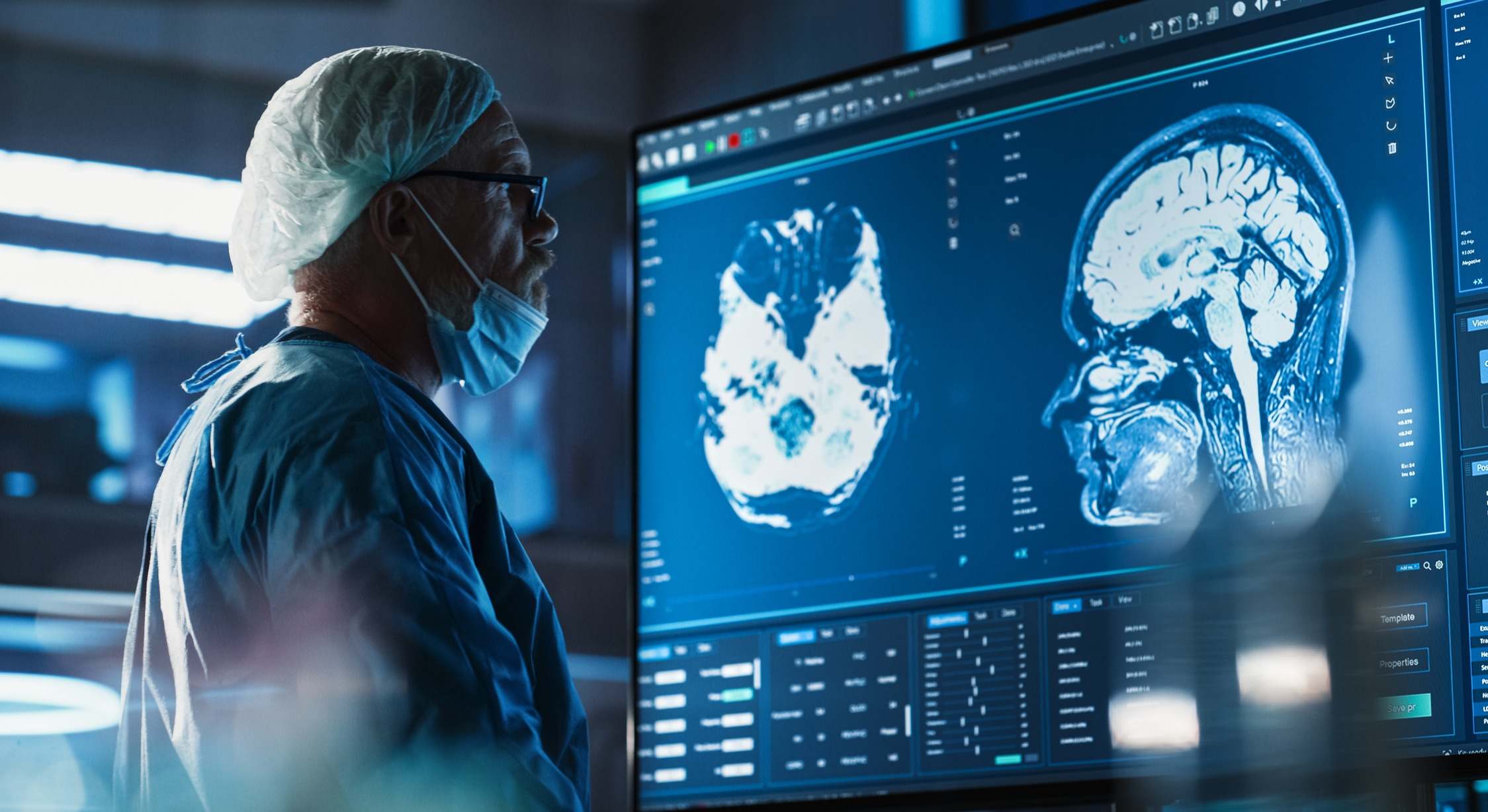 Médico observando un escáner cerebral