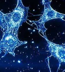 cancer_metastasis.jpg