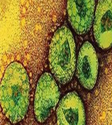virus2.jpg