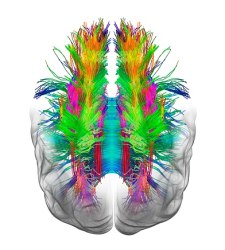 cerebro-neuronas.jpg