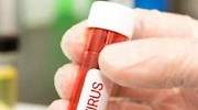 Cinco fármacos ultiman los ensayos para convertirse en la cura del virus