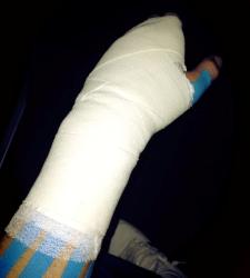 casillas-brazo-lesionado.jpg