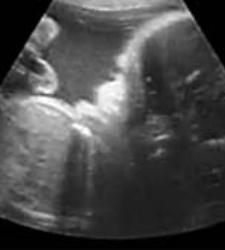 campana_aborto.jpg