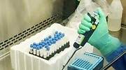 López Guerrero (Neurovirólogo): Es imposible que el coronavirus se haya creado en un laboratorio