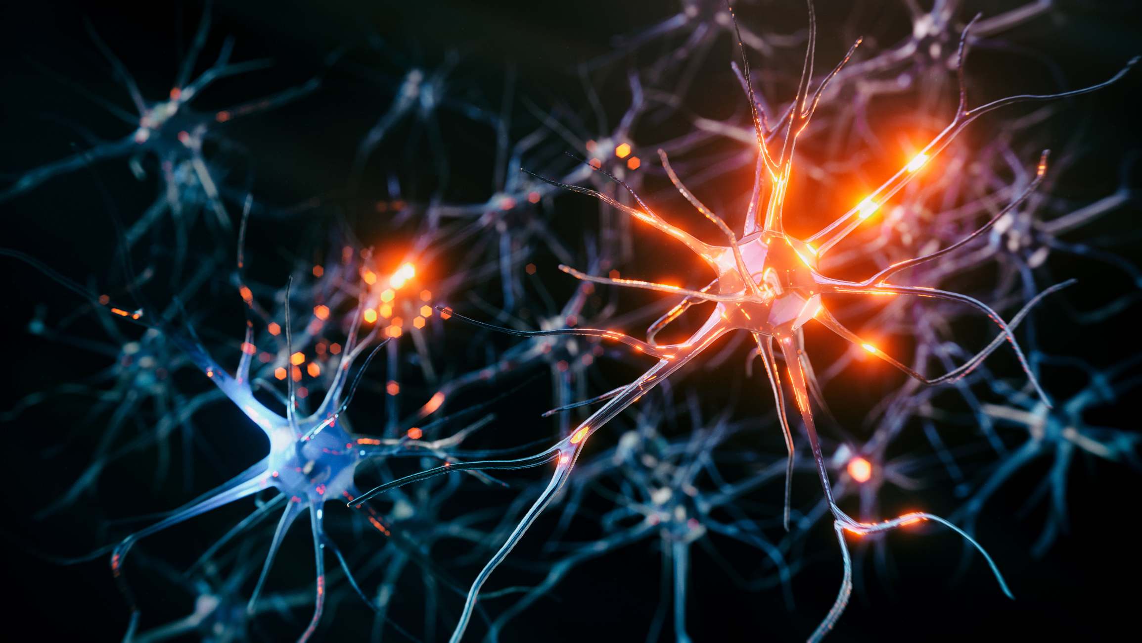 Alzheimer