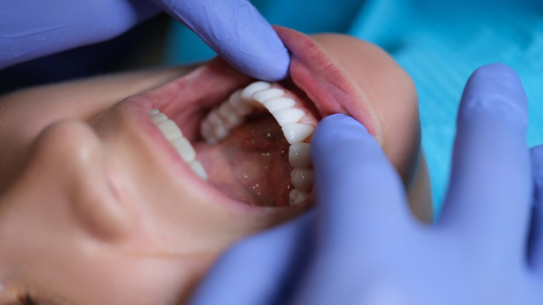 Persona con la boca abierta en el dentista