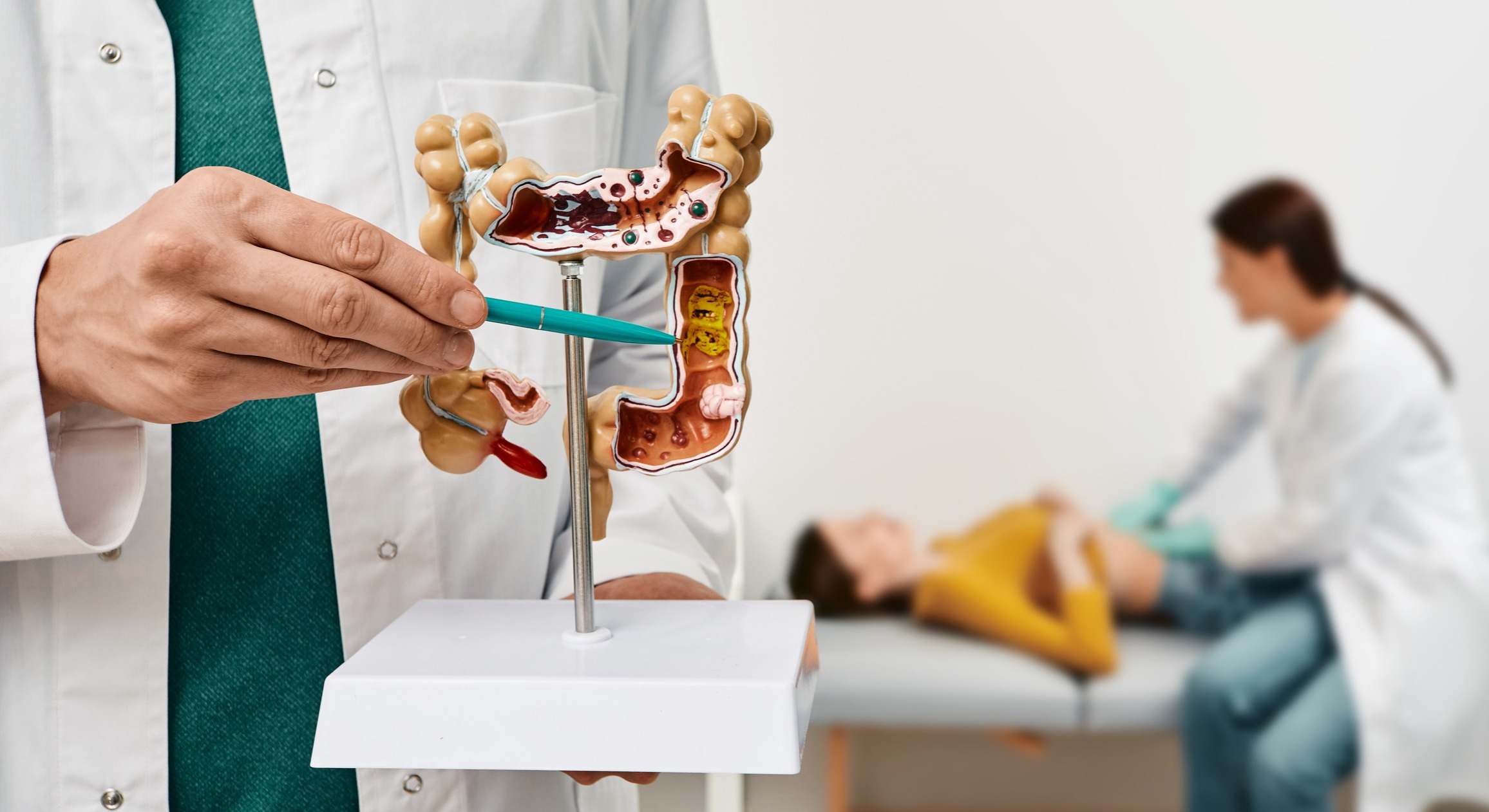 Modelo anatómico de intestinos con patología en manos de médico