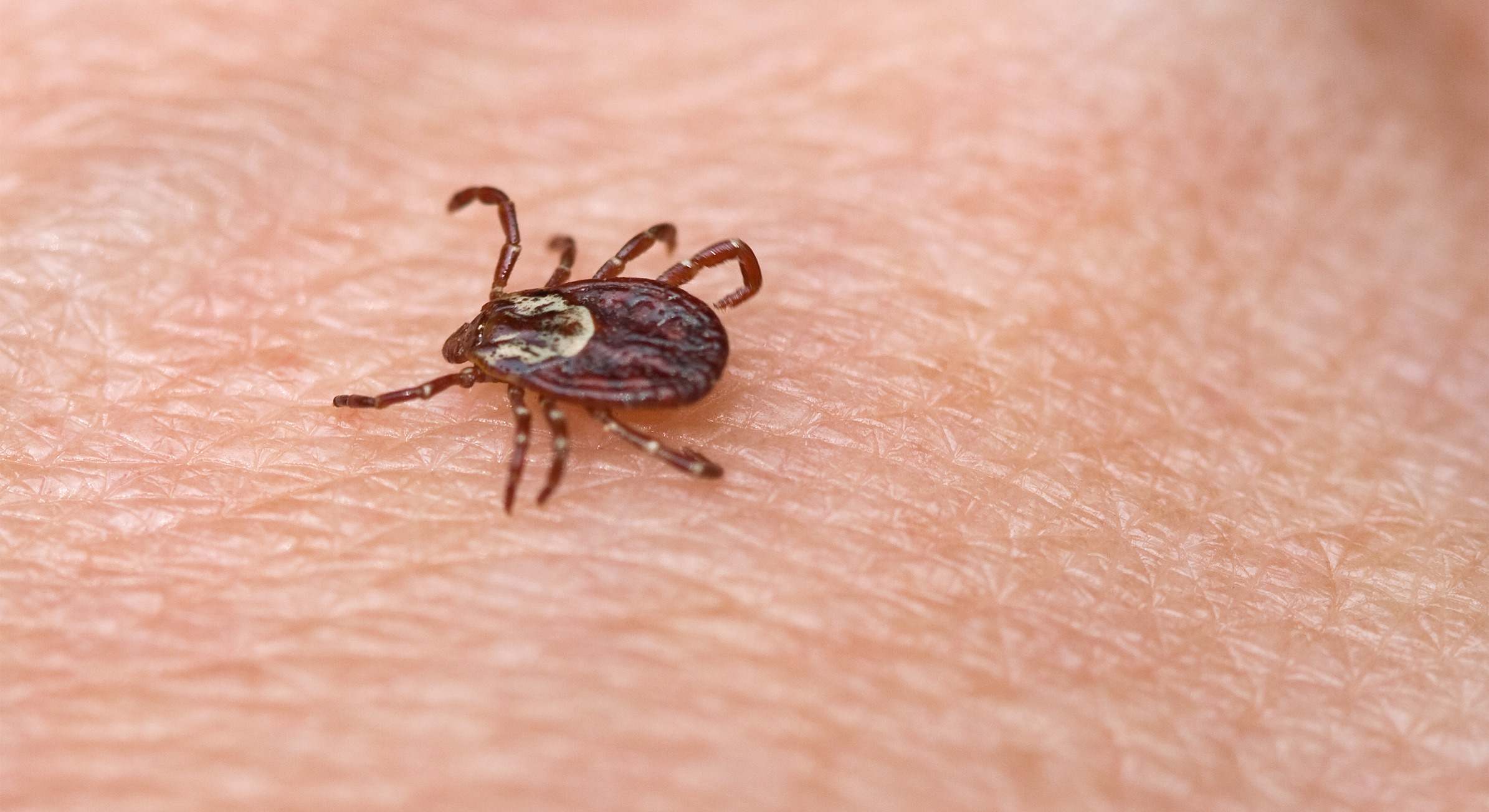 La FHCC la produce un virus transmitido por la picadura de una garrapata infectada