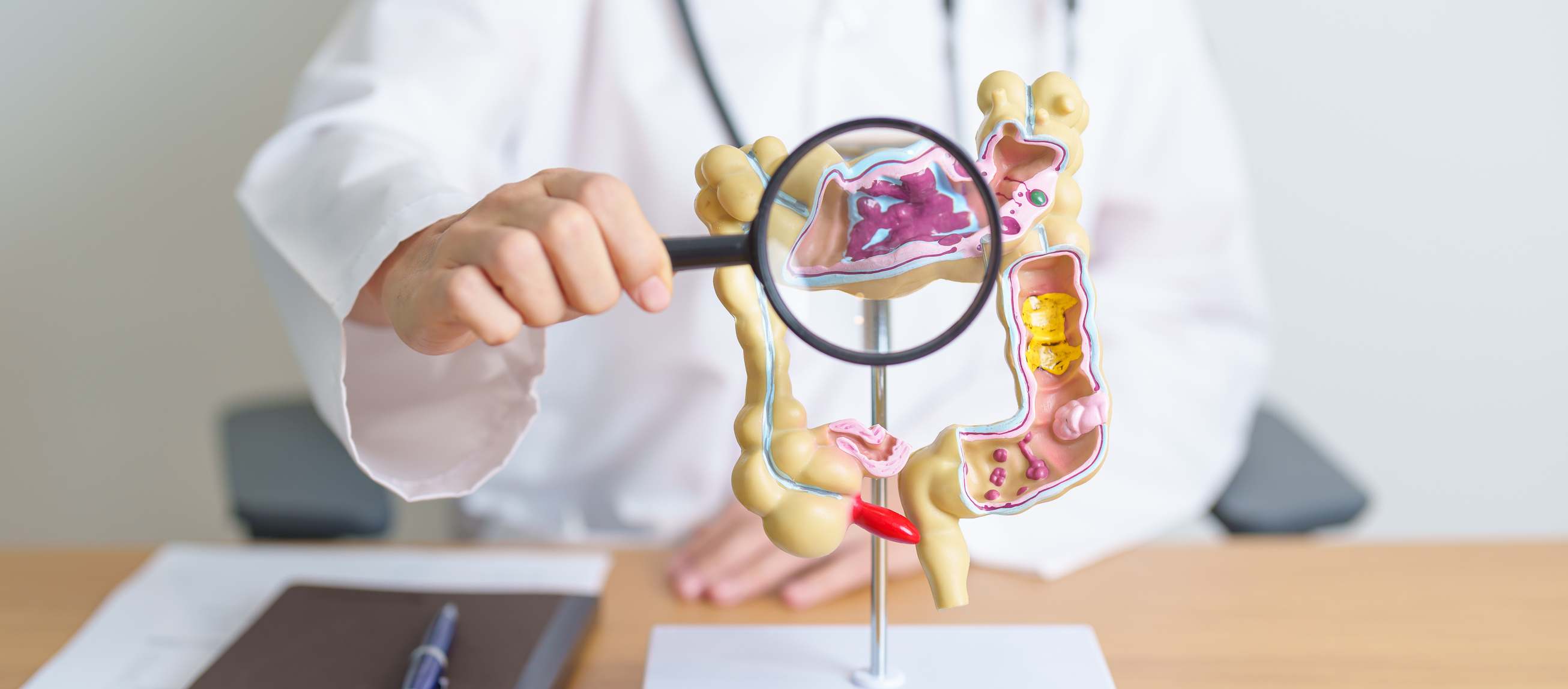 Enfermedad de Crohn. / Foto: iStock
