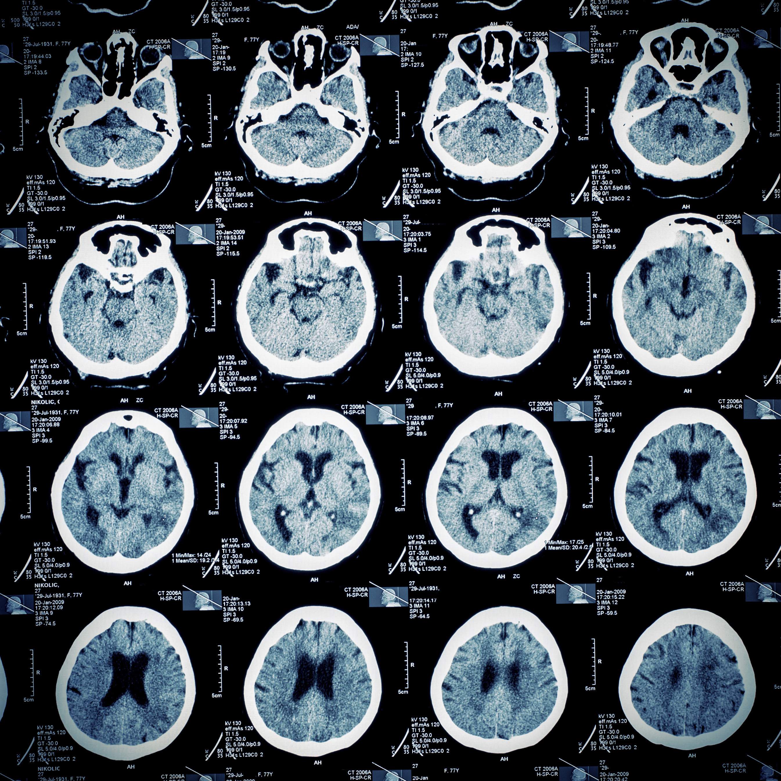 neurociencia.jpg