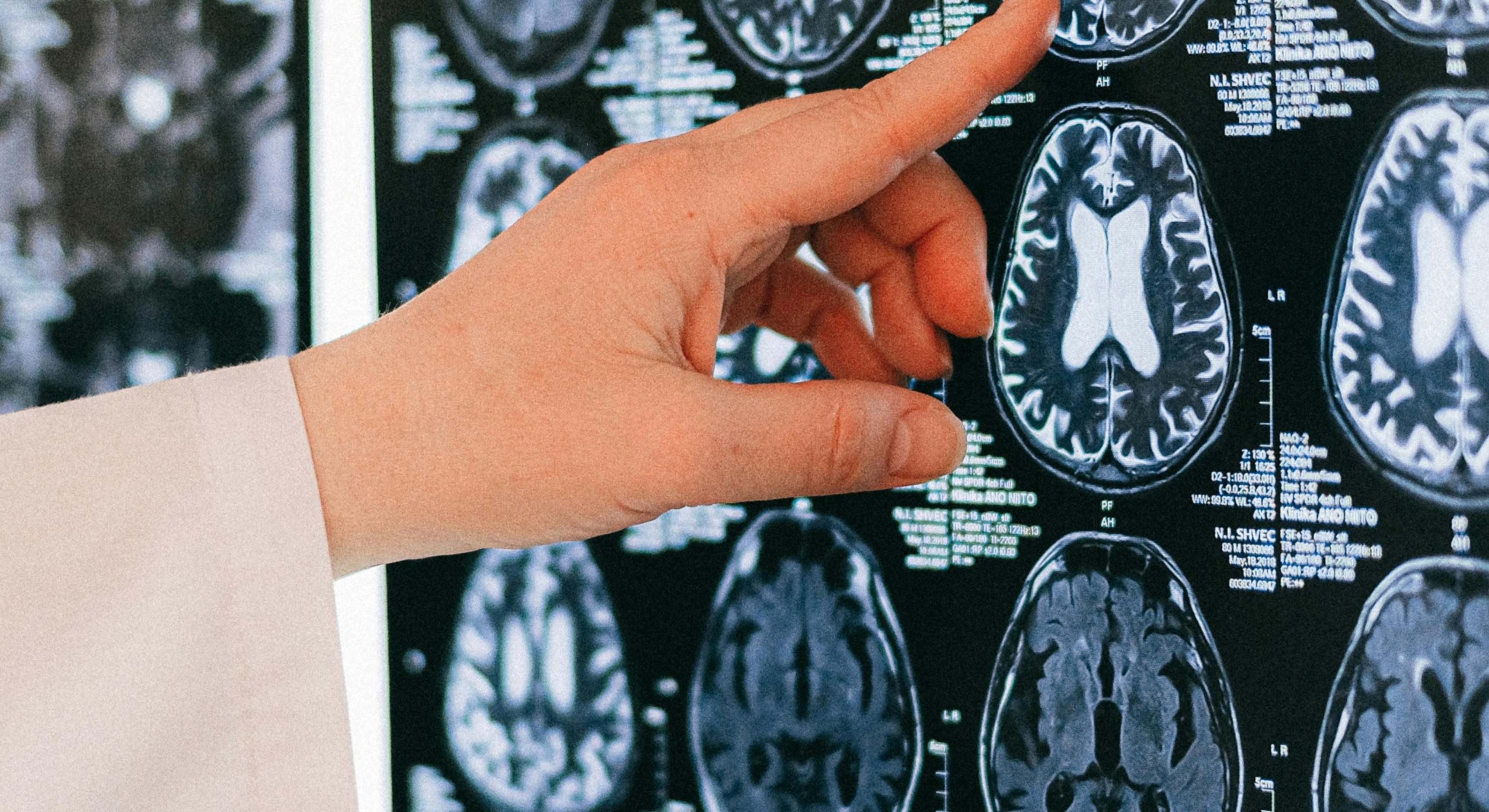 Escáner cerebral