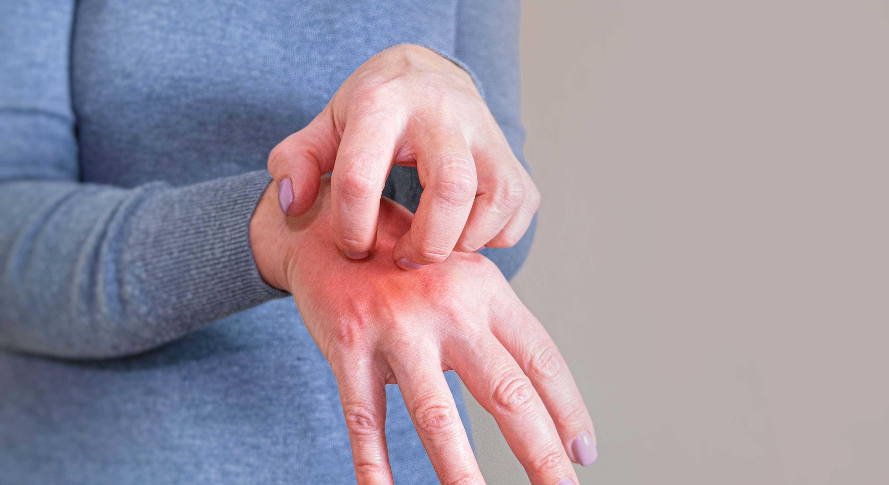 Mujer se rasca la mano